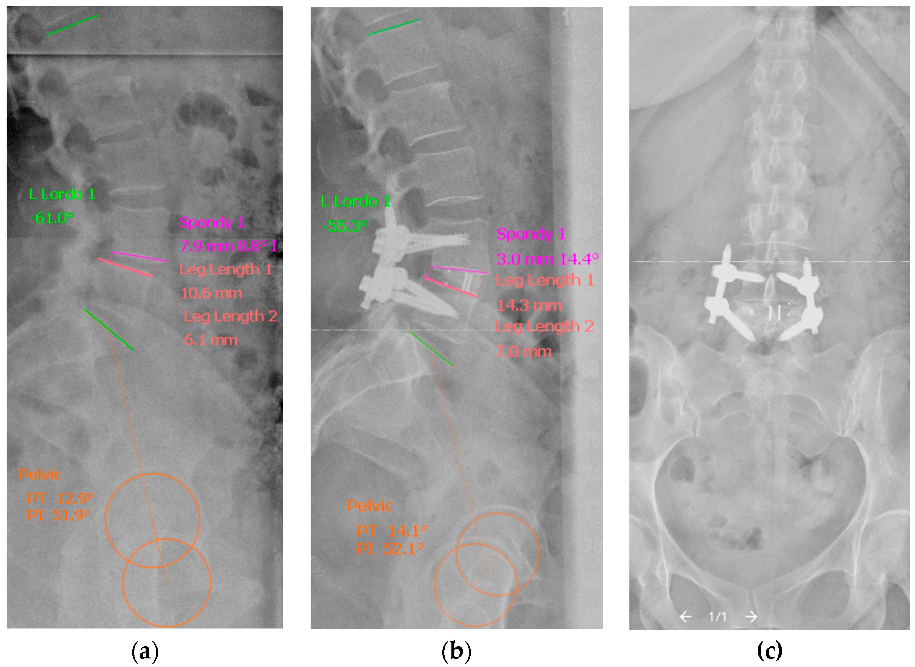 Jcm 14 07595 g002 Jcm 14 07595 g002