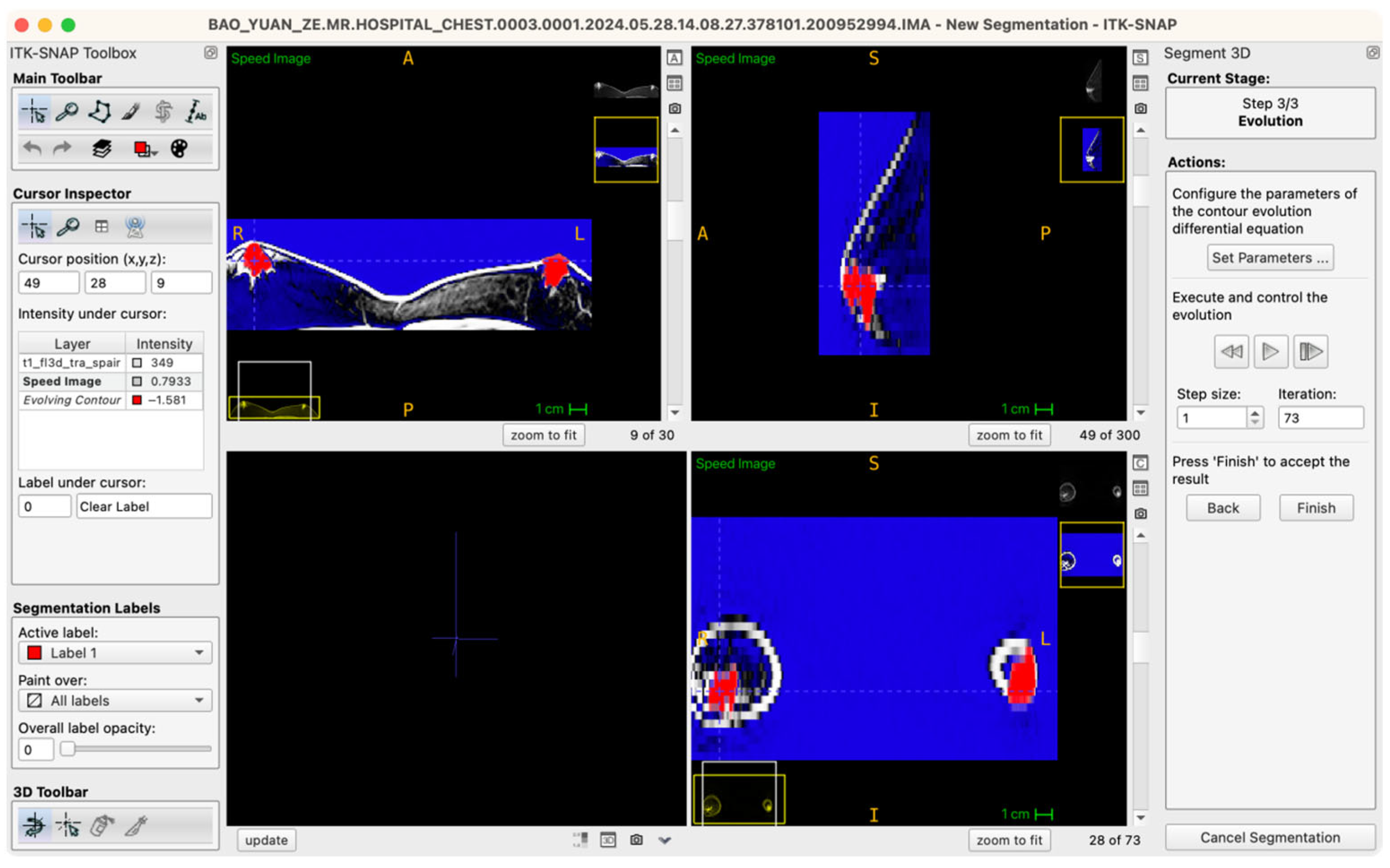 Jcm 14 07601 g004 Jcm 14 07601 g004