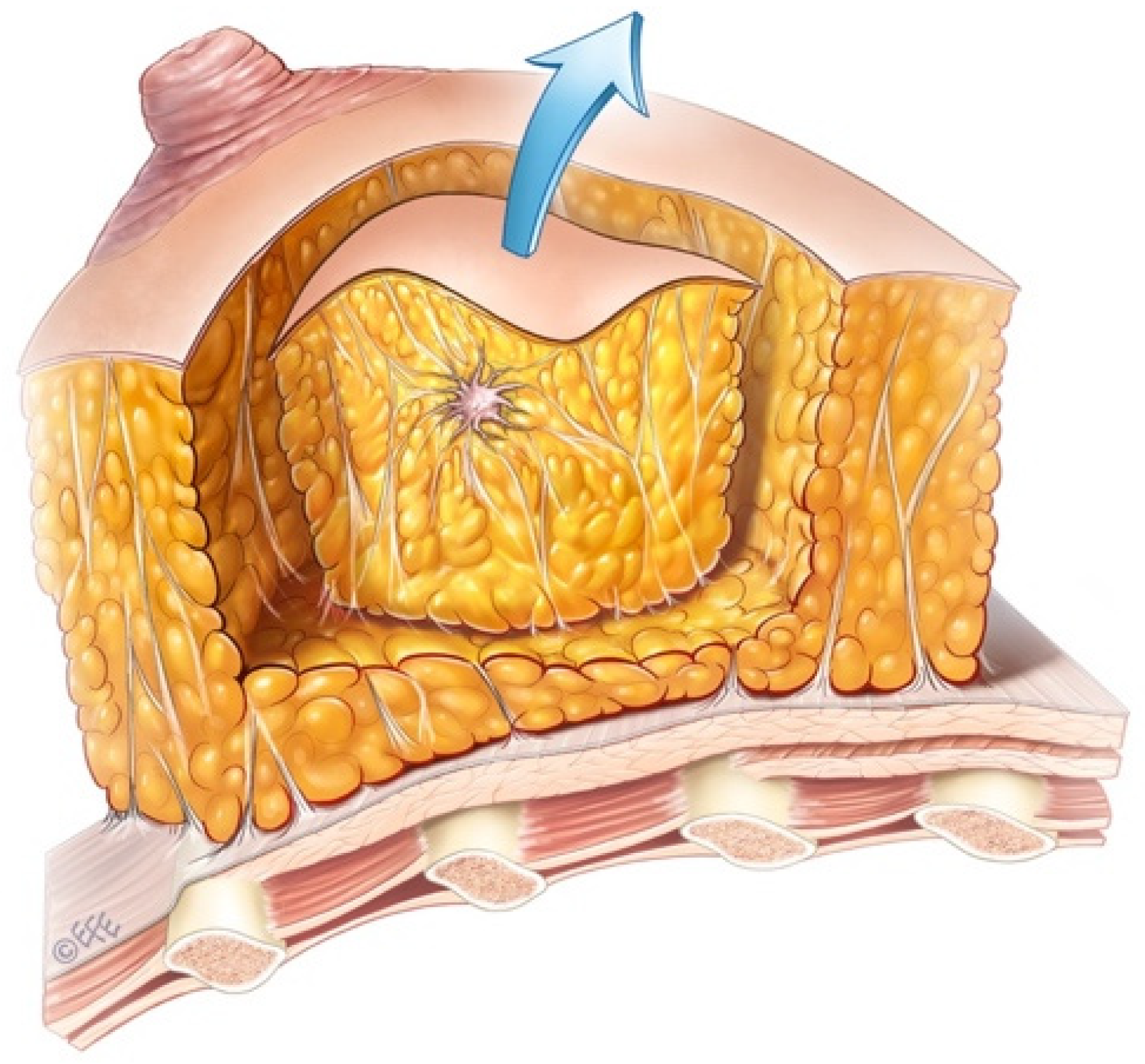 Jcm 14 07706 g001 Jcm 14 07706 g001