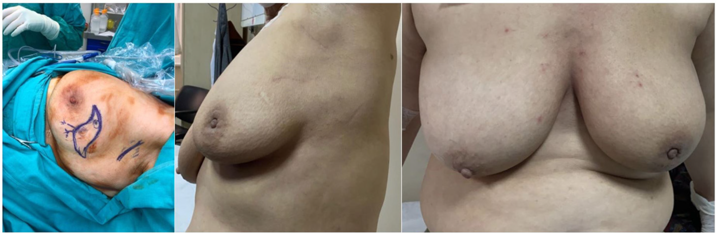 Jcm 14 07706 g003 Jcm 14 07706 g003