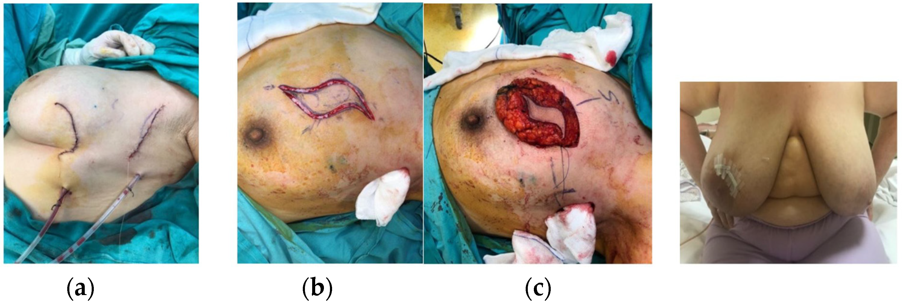 Jcm 14 07706 g004 Jcm 14 07706 g004