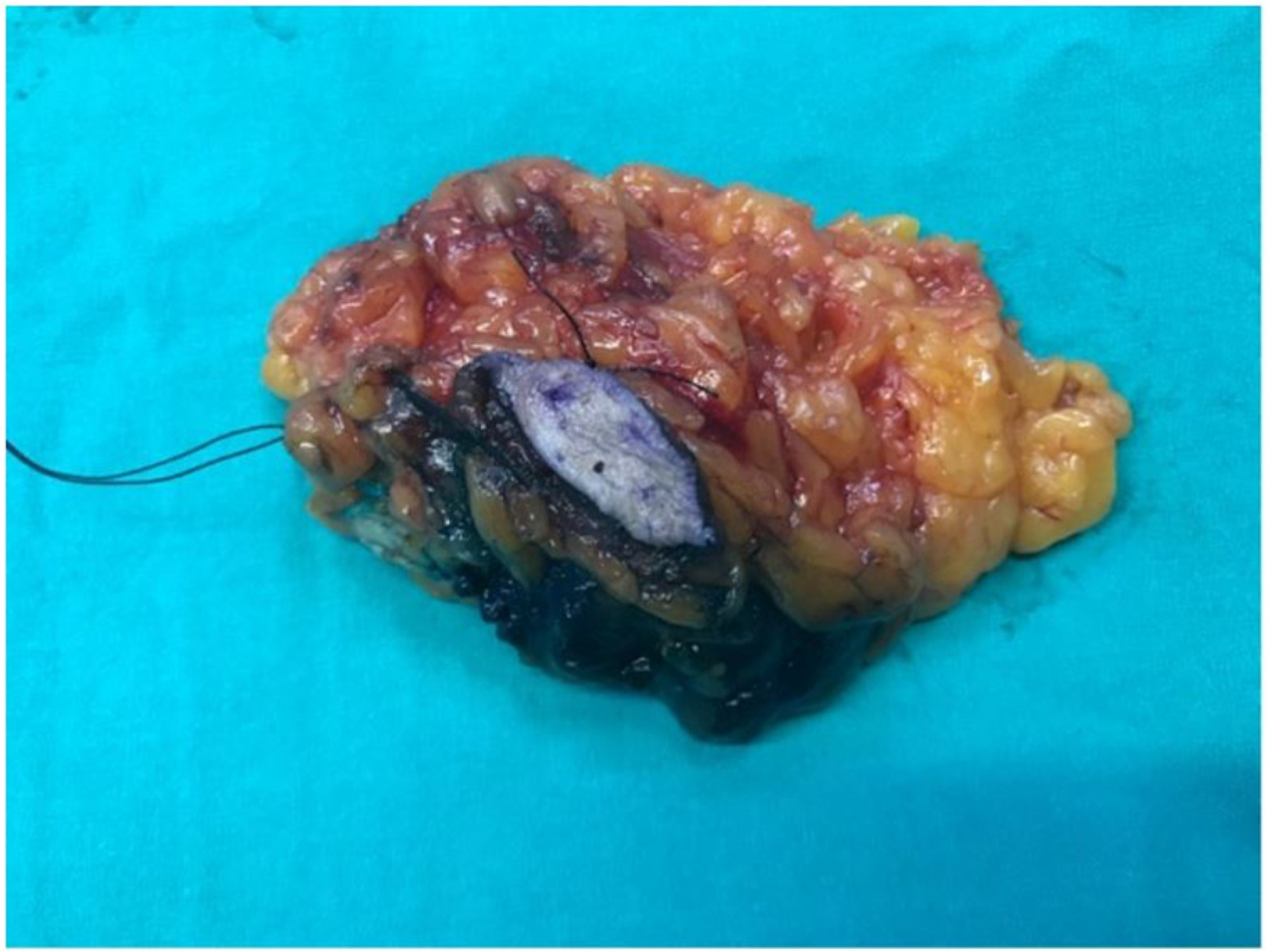 Jcm 14 07706 g005 Jcm 14 07706 g005