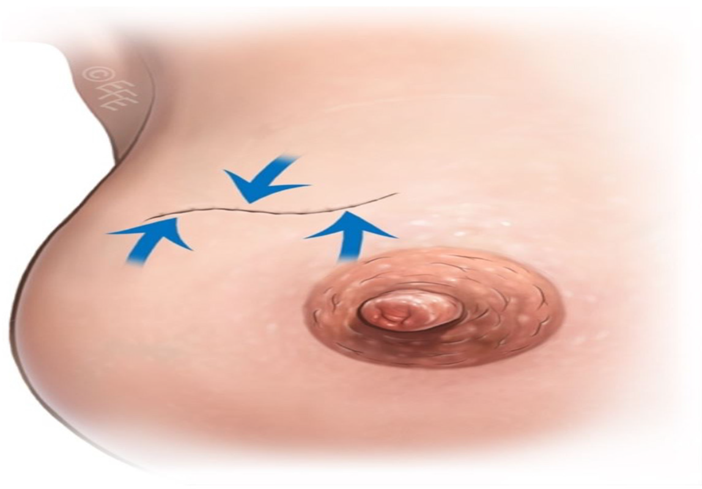 Jcm 14 07706 g006 Jcm 14 07706 g006