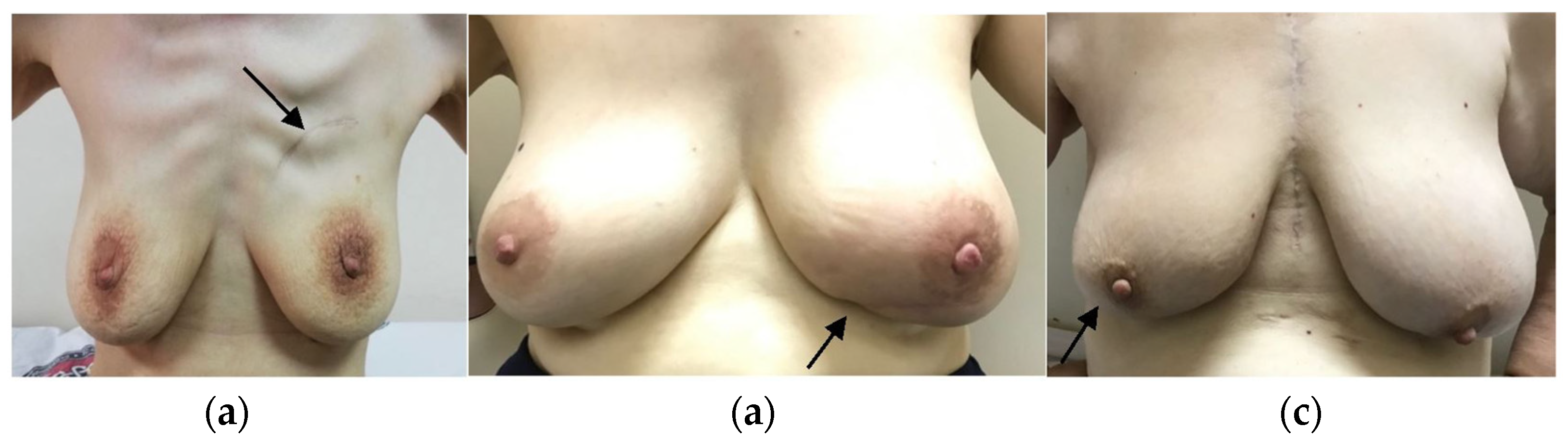 Jcm 14 07706 g007 Jcm 14 07706 g007