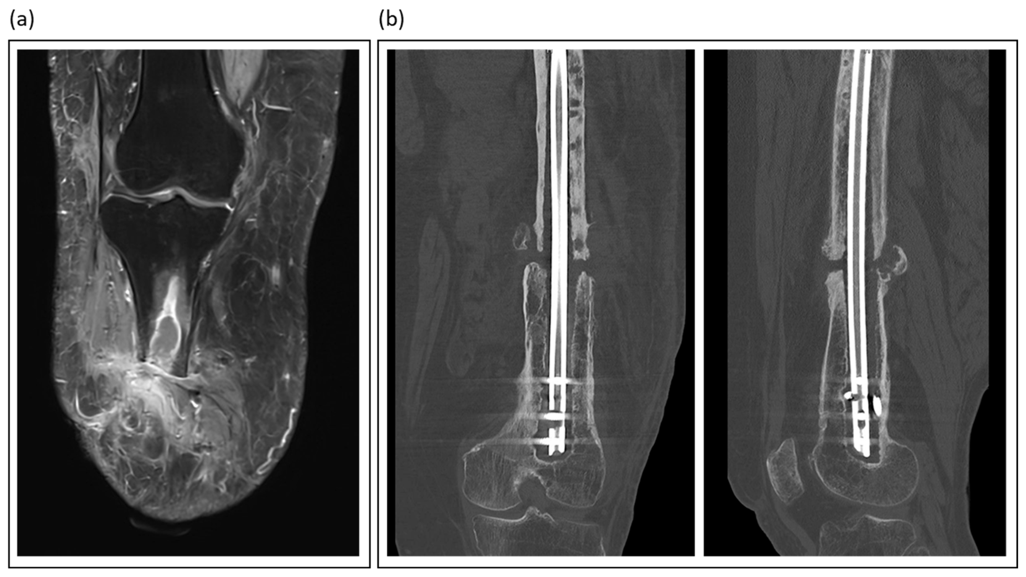 Jcm 14 07767 g002 Jcm 14 07767 g002