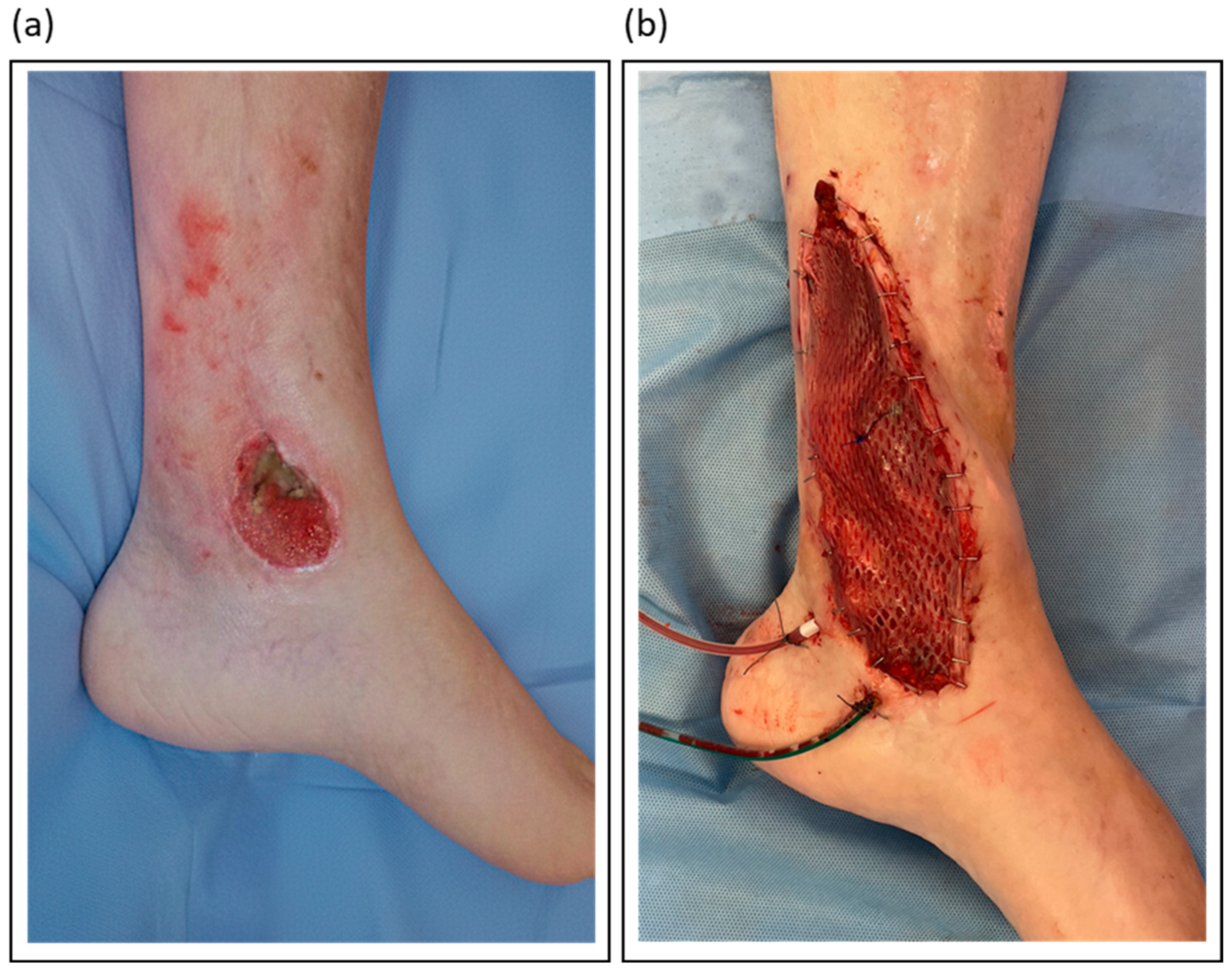 Jcm 14 07767 g003 Jcm 14 07767 g003