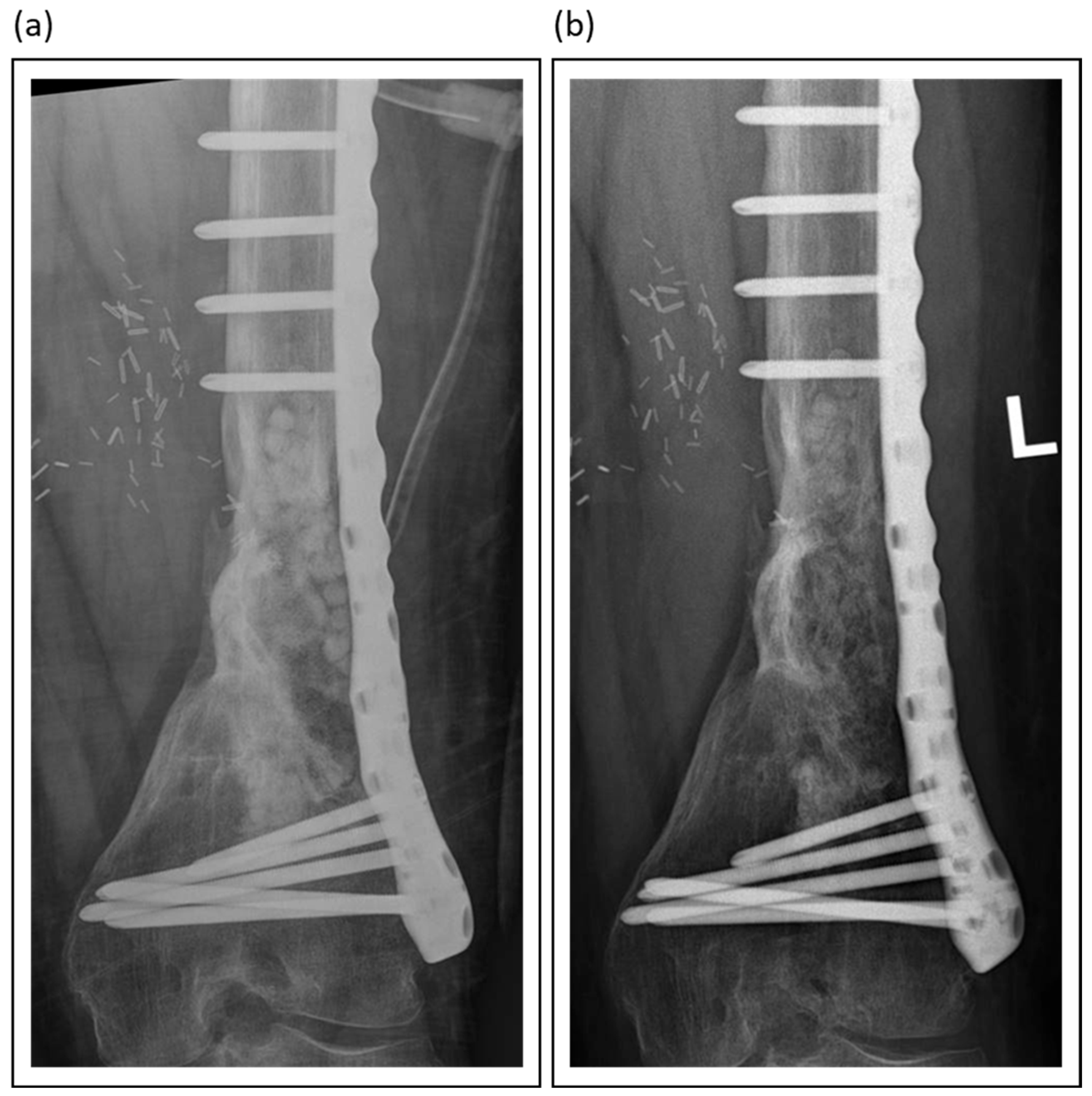 Jcm 14 07767 g004 Jcm 14 07767 g004