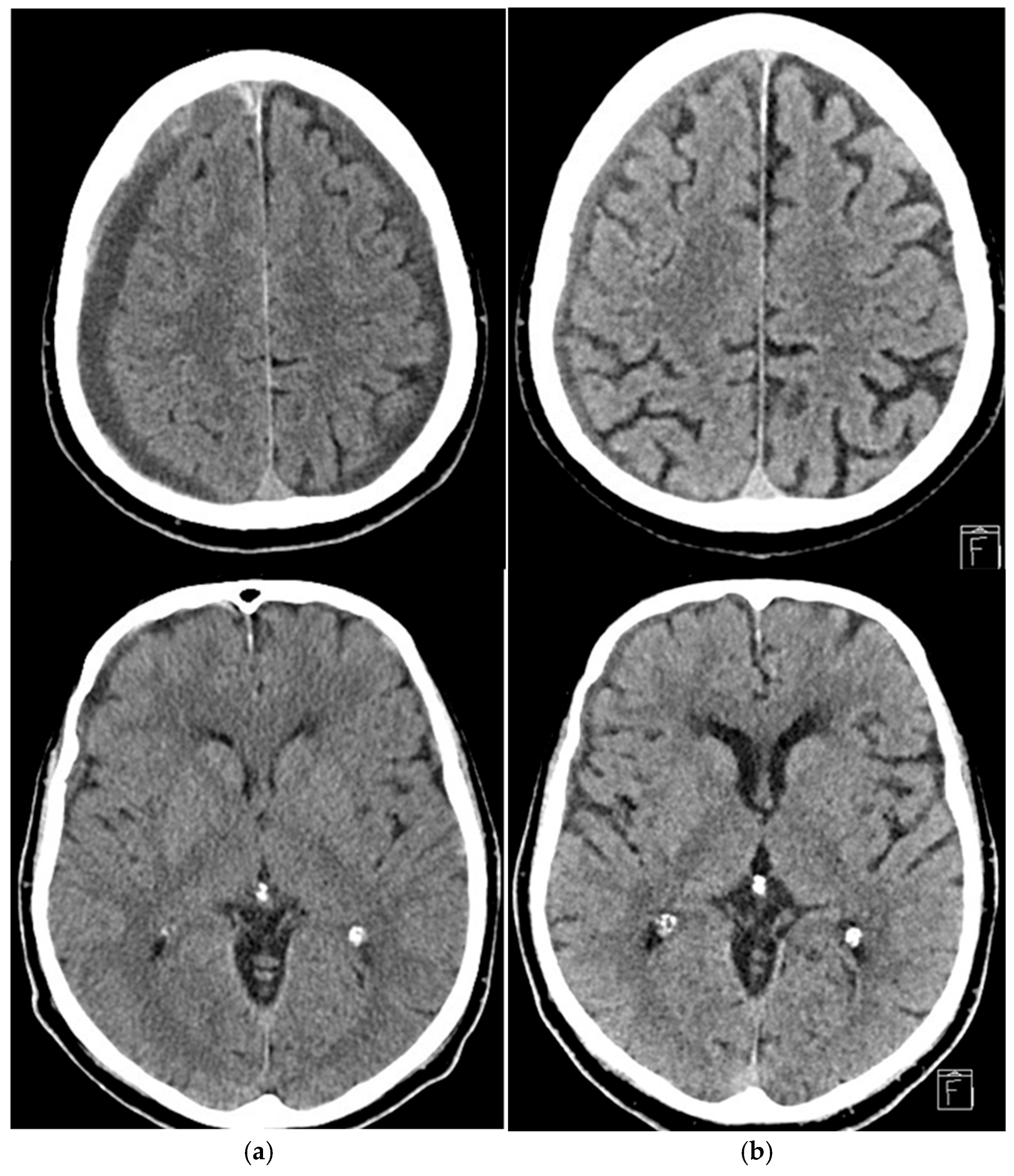 Jcm 14 08226 g003 Jcm 14 08226 g003