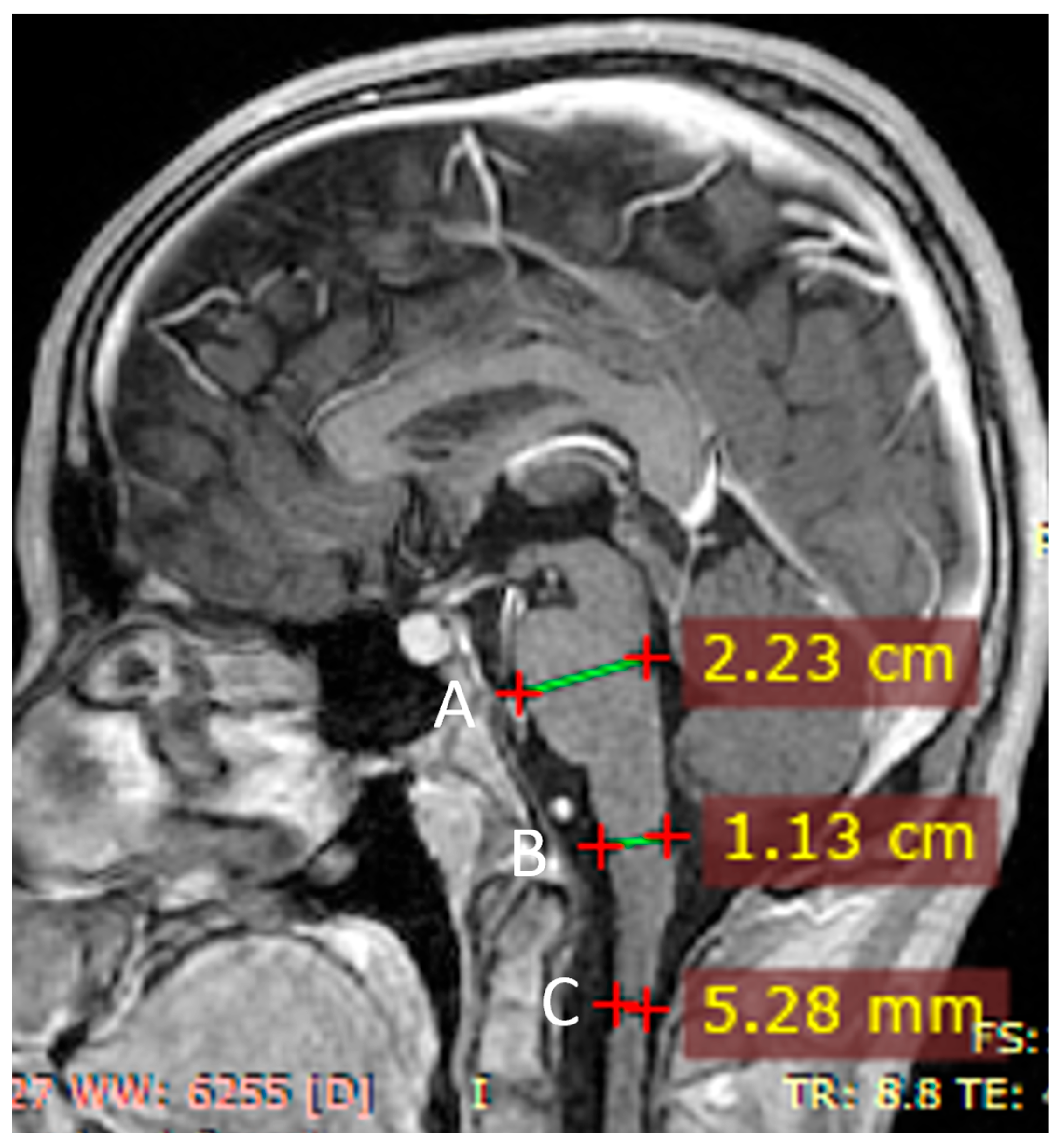 Jcm 14 08232 g005