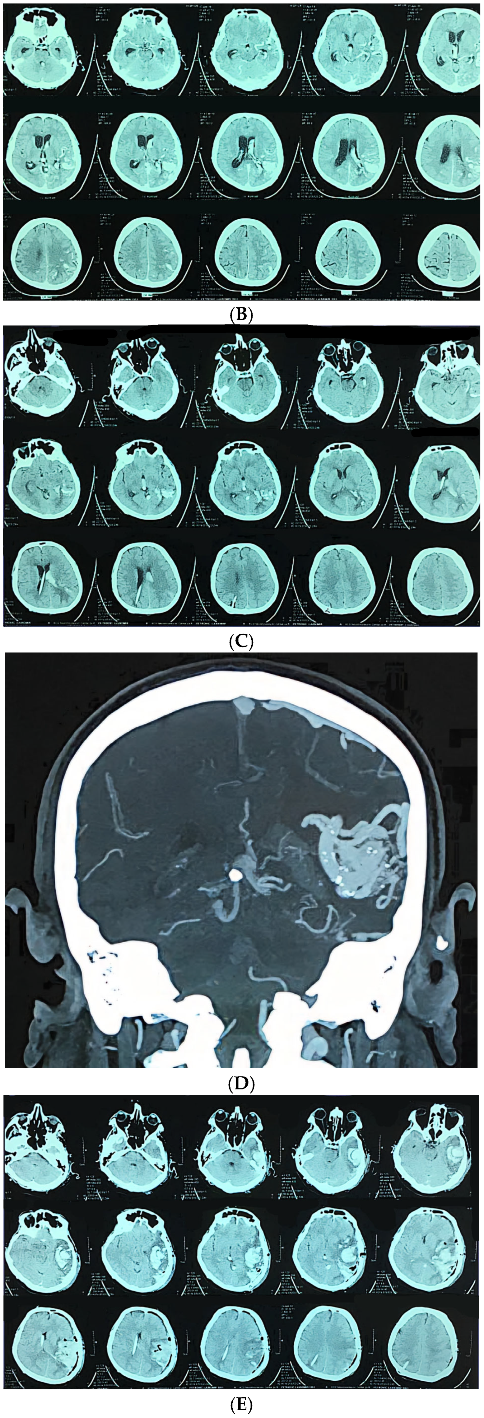 Jcm 14 08680 g003b Jcm 14 08680 g003b