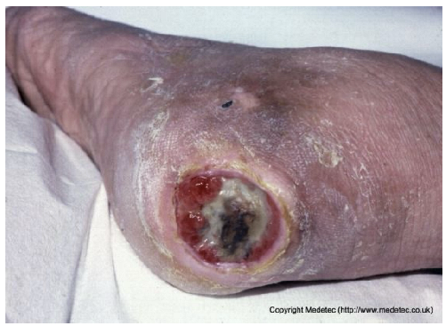 Jcm 14 08825 i017 Jcm 14 08825 i017