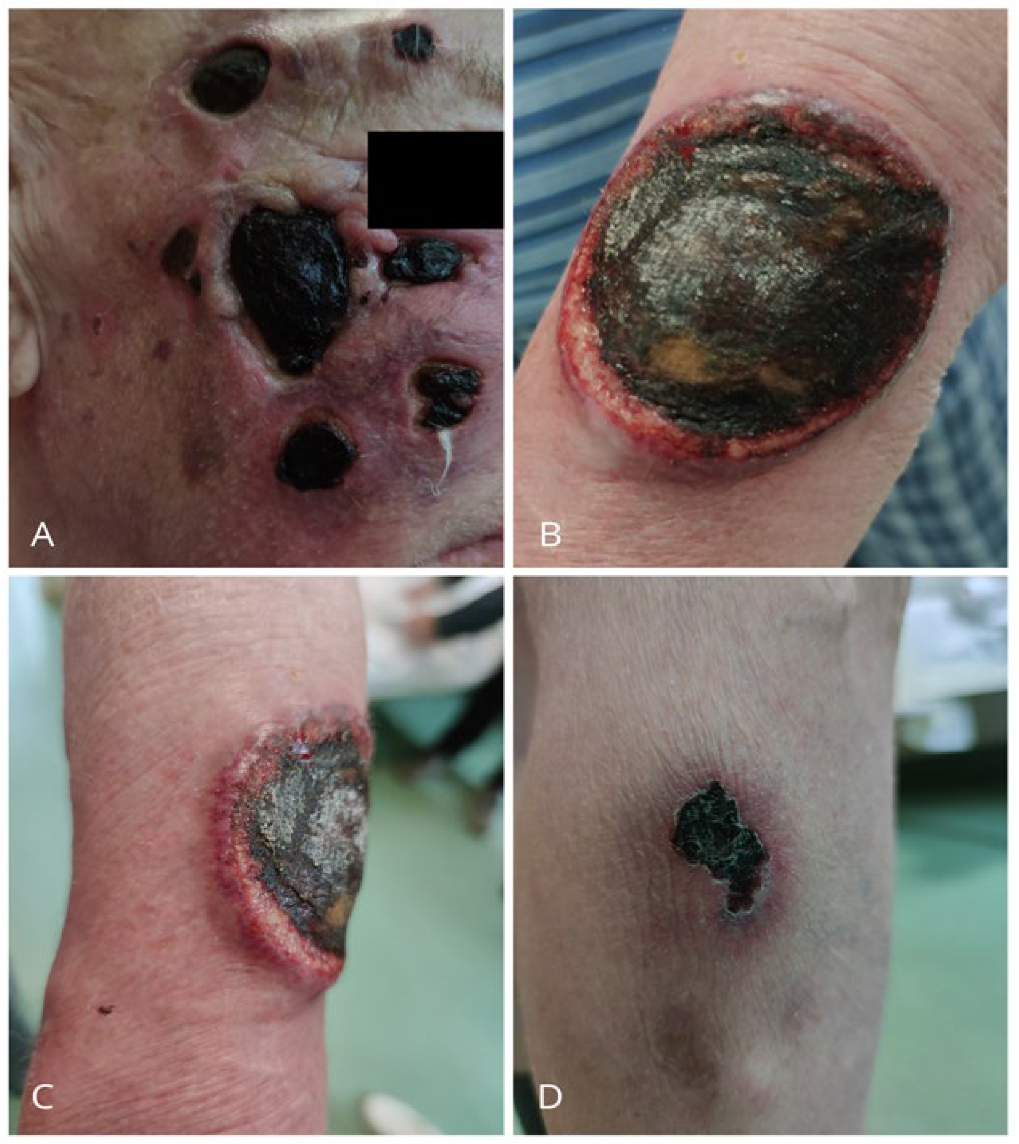 Jcm 15 01138 g001 Jcm 15 01138 g001