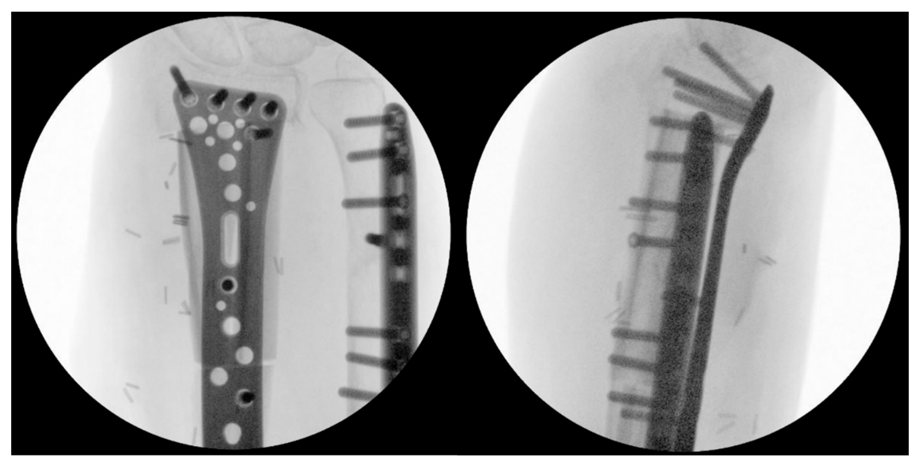 Jcm 15 01857 g007 Jcm 15 01857 g007