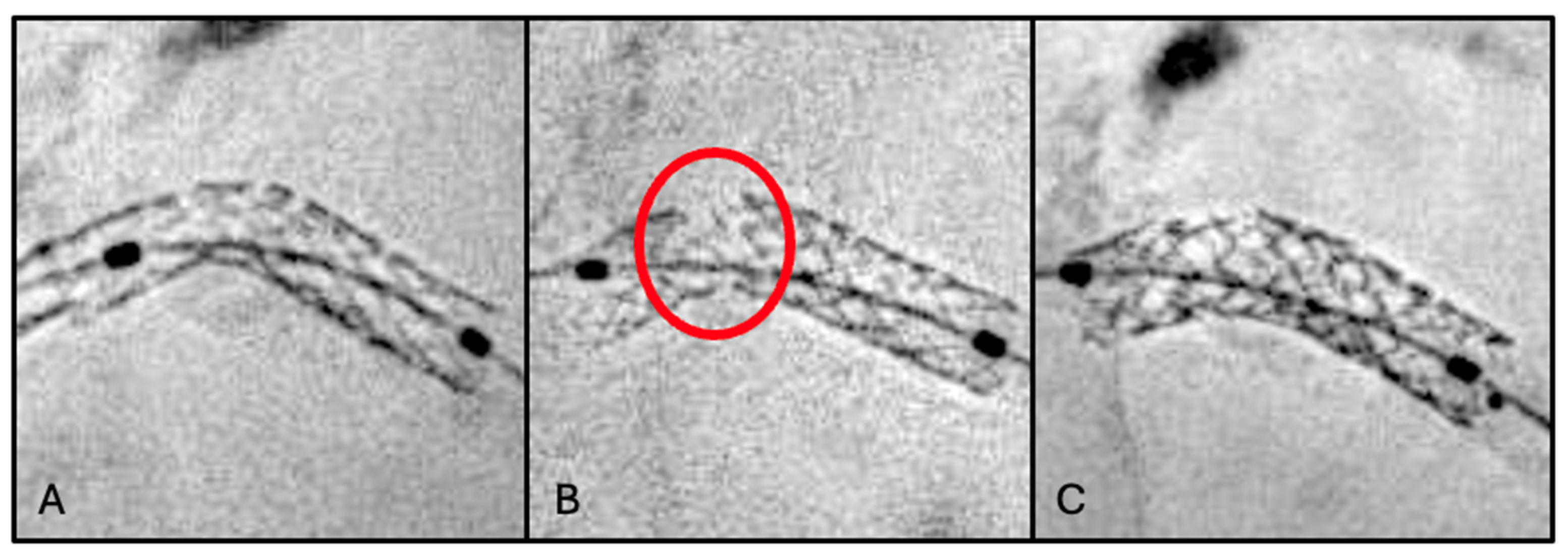 Jcm 15 03907 g001 Jcm 15 03907 g001