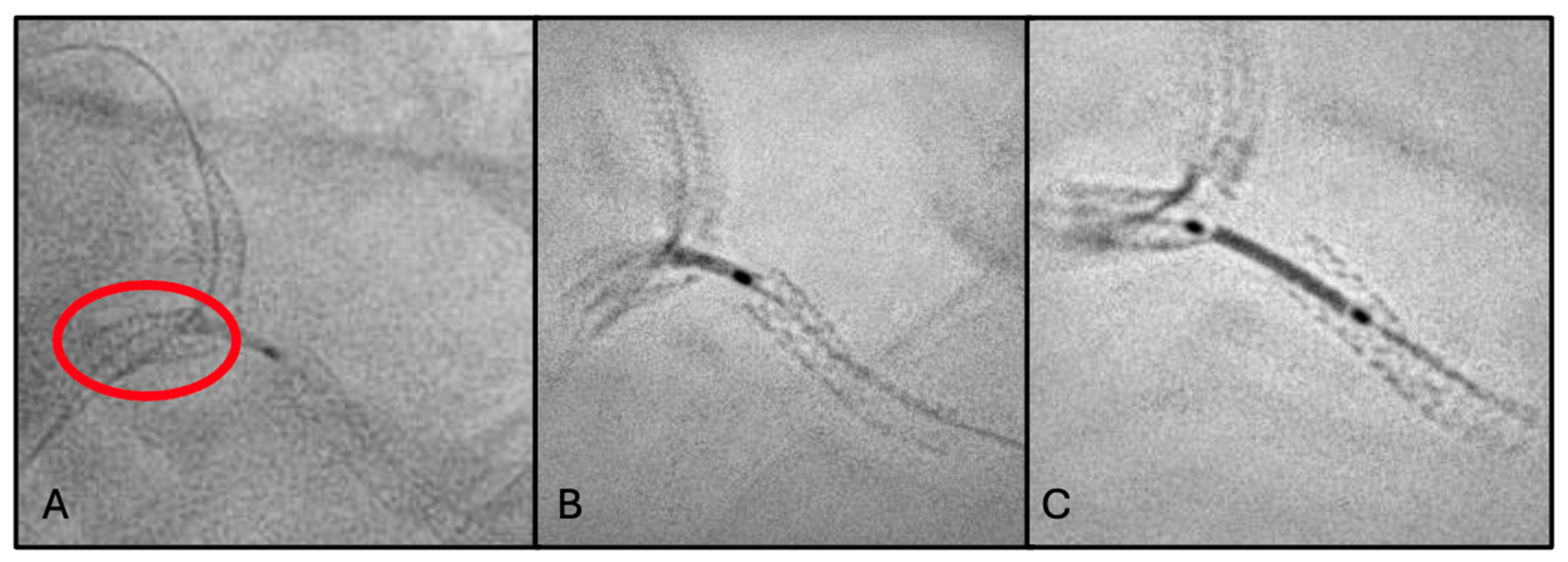 Jcm 15 03907 g003 Jcm 15 03907 g003