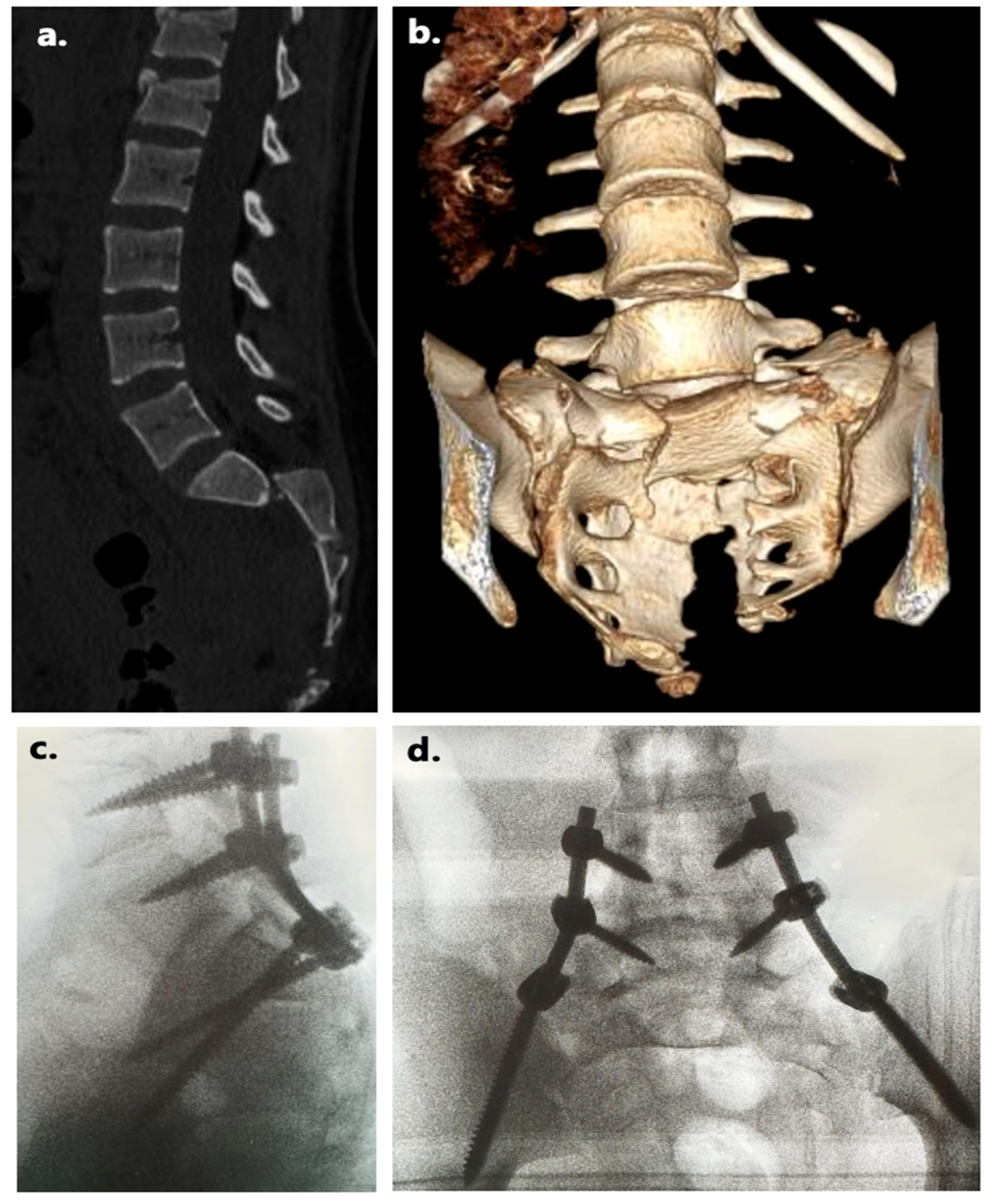 Jcm 15 04914 g003 Jcm 15 04914 g003
