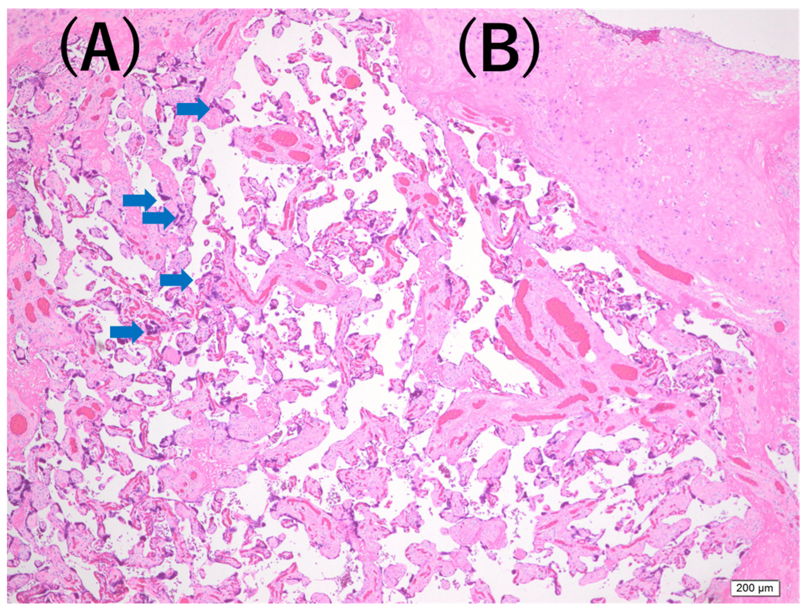 Jcm 15 05734 g002 Jcm 15 05734 g002