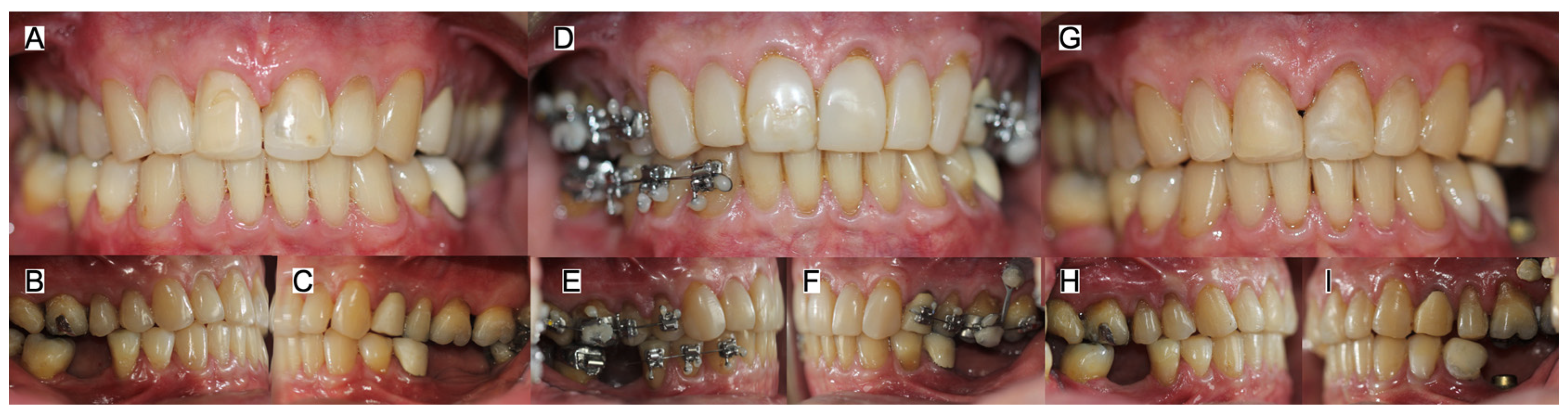 Jcm 15 07511 g002 Jcm 15 07511 g002