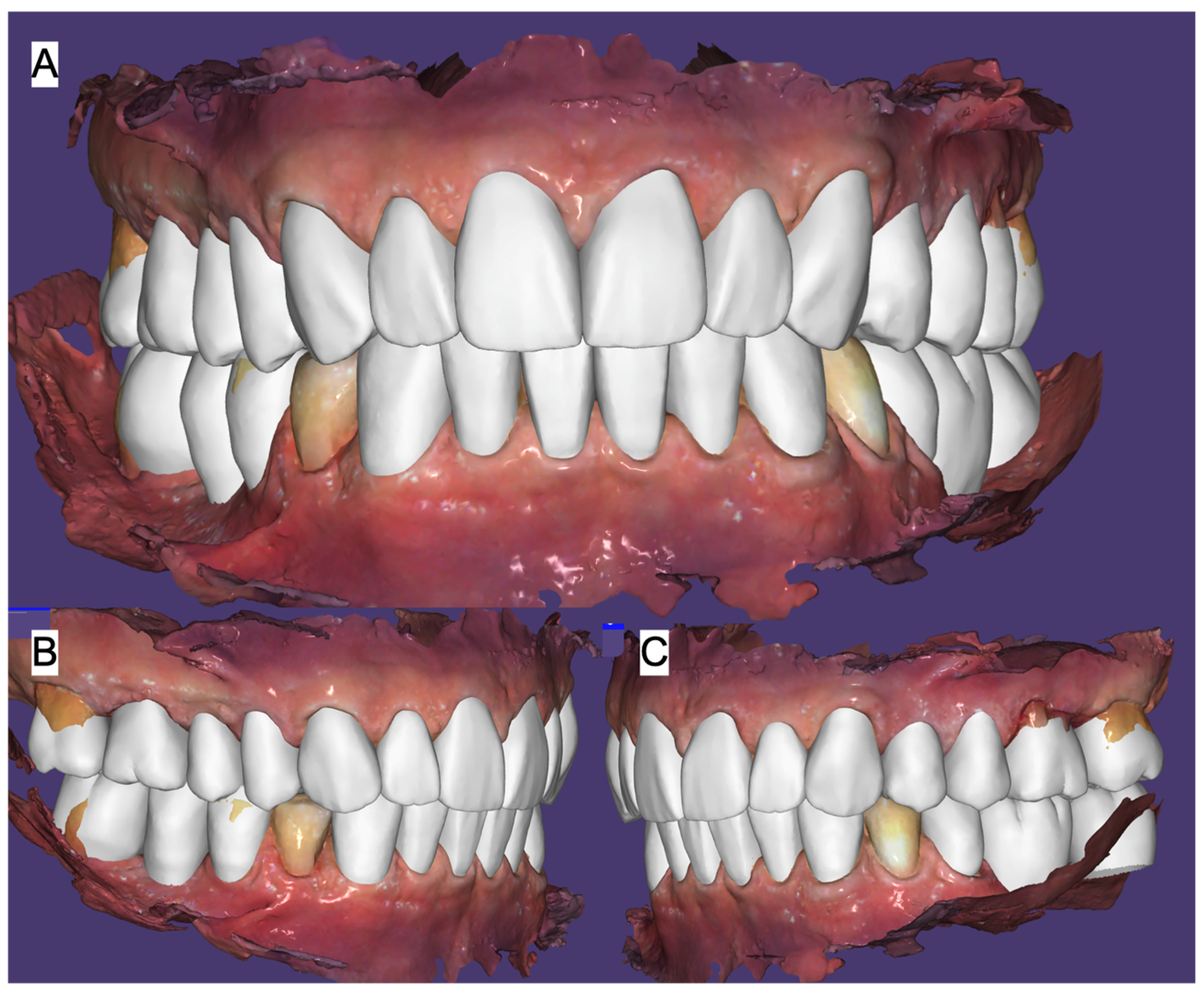 Jcm 15 07511 g005 Jcm 15 07511 g005
