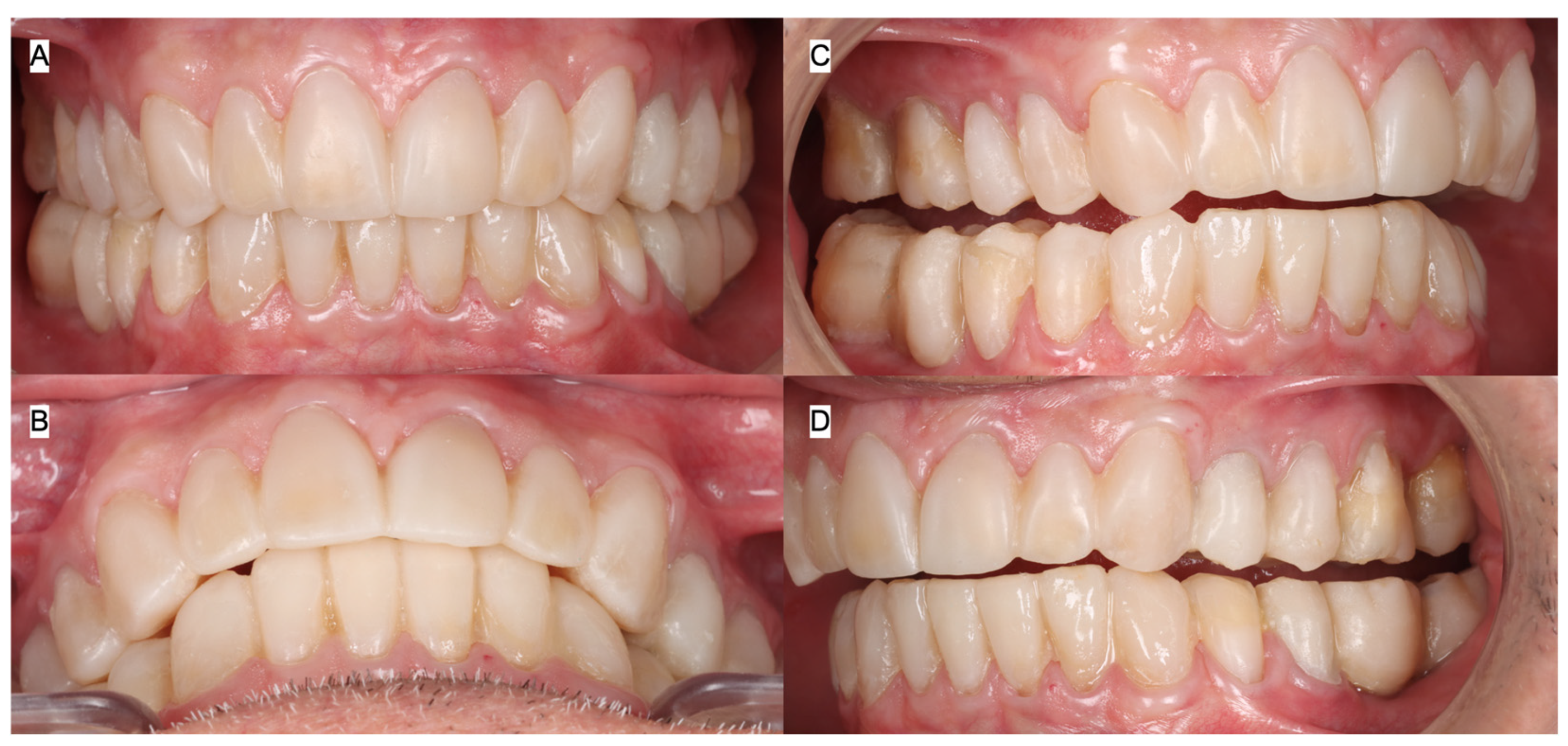 Jcm 15 07511 g006 Jcm 15 07511 g006