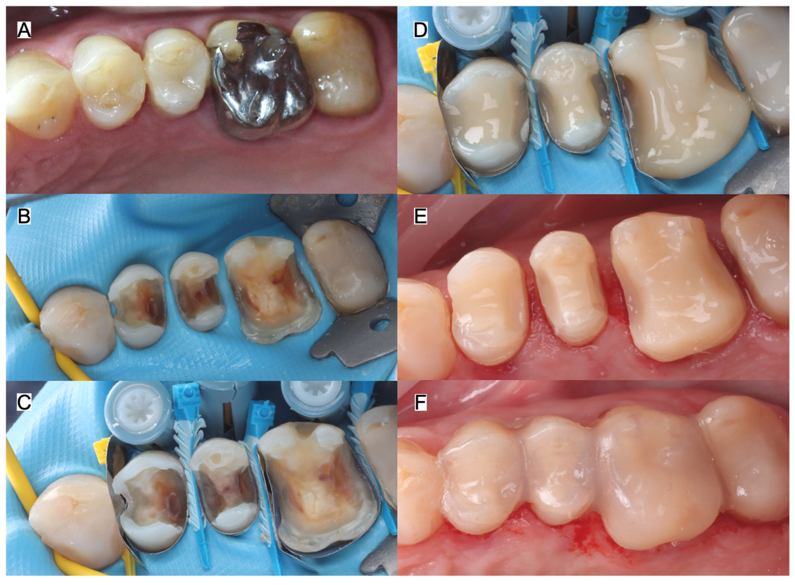 Jcm 15 07511 g007 Jcm 15 07511 g007