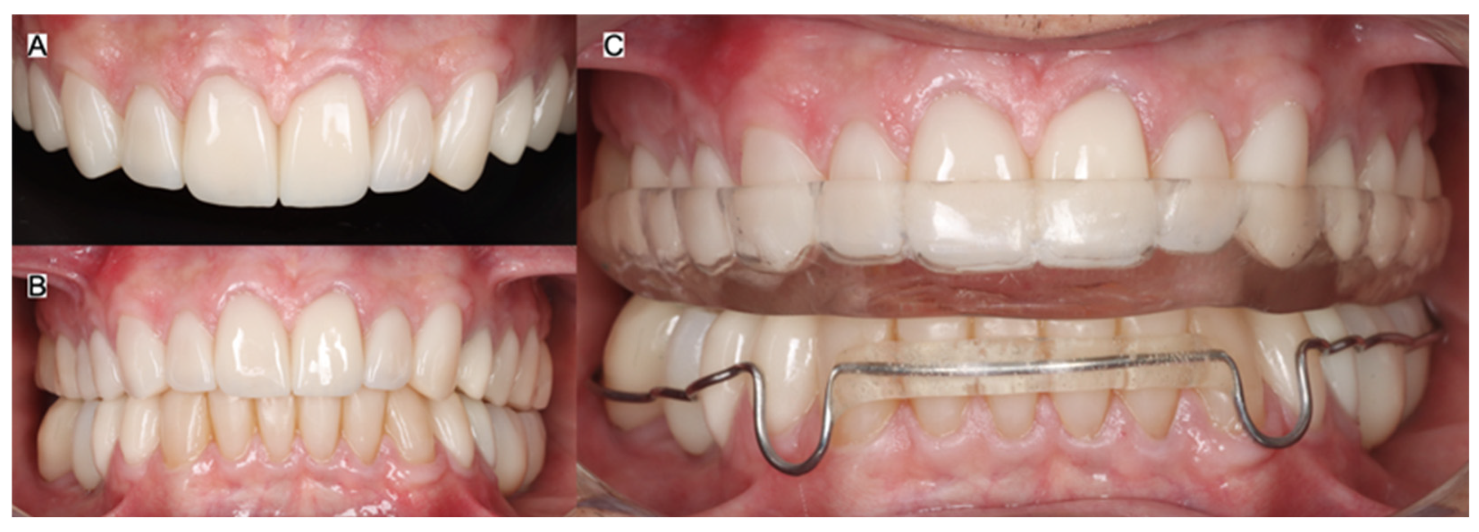 Jcm 15 07511 g012 Jcm 15 07511 g012