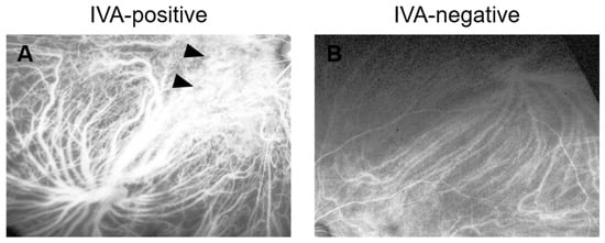 Automated Regional Detection of Intervortex Venous Anastomosis on Ultra ...
