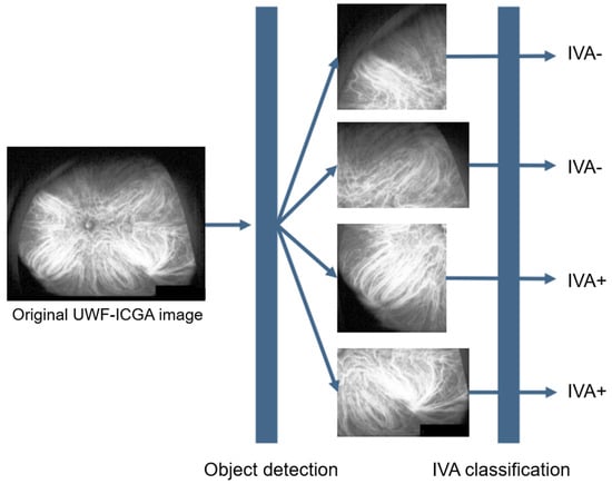 Automated Regional Detection of Intervortex Venous Anastomosis on Ultra ...