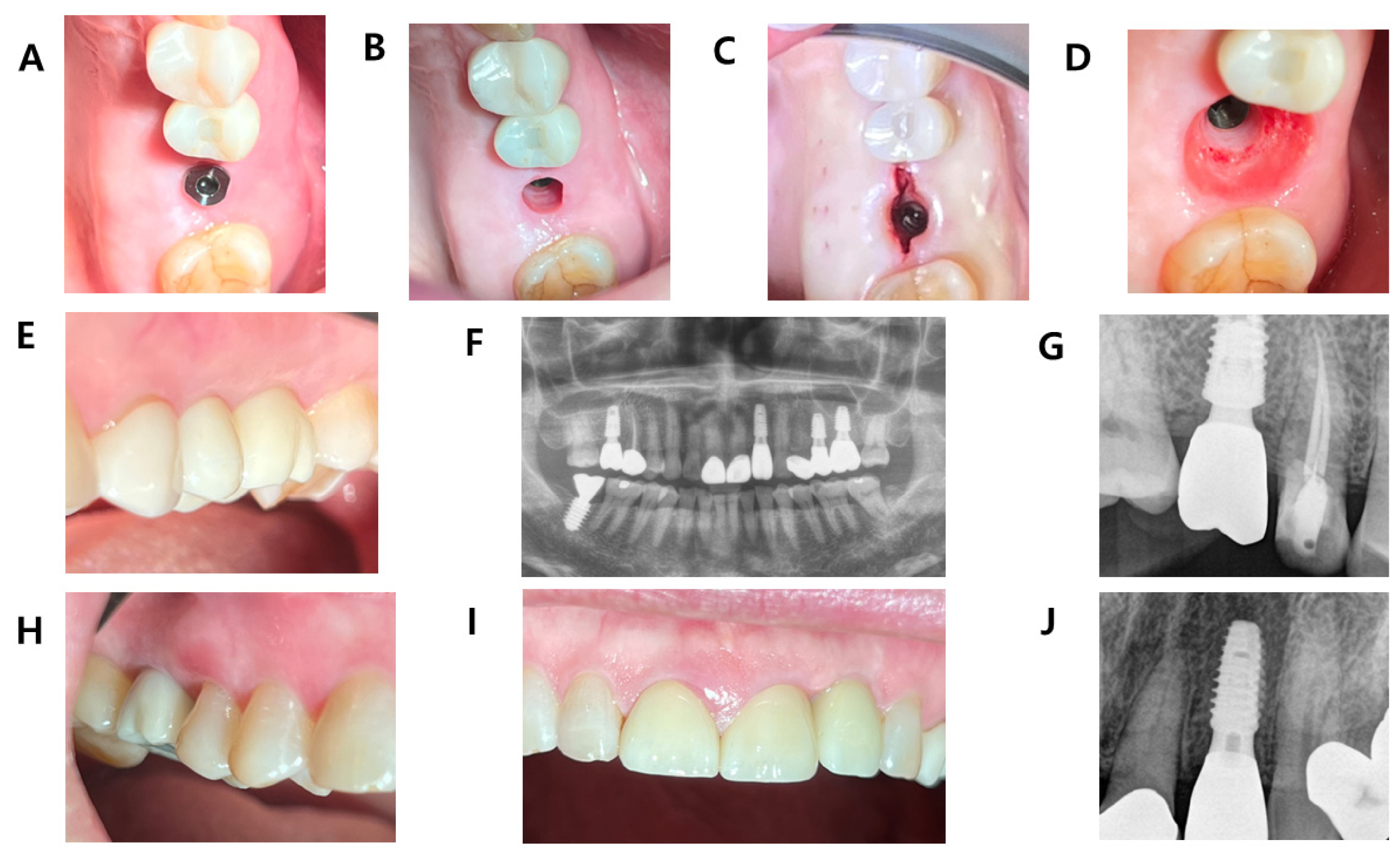 Jcm 15 07807 g003 Jcm 15 07807 g003