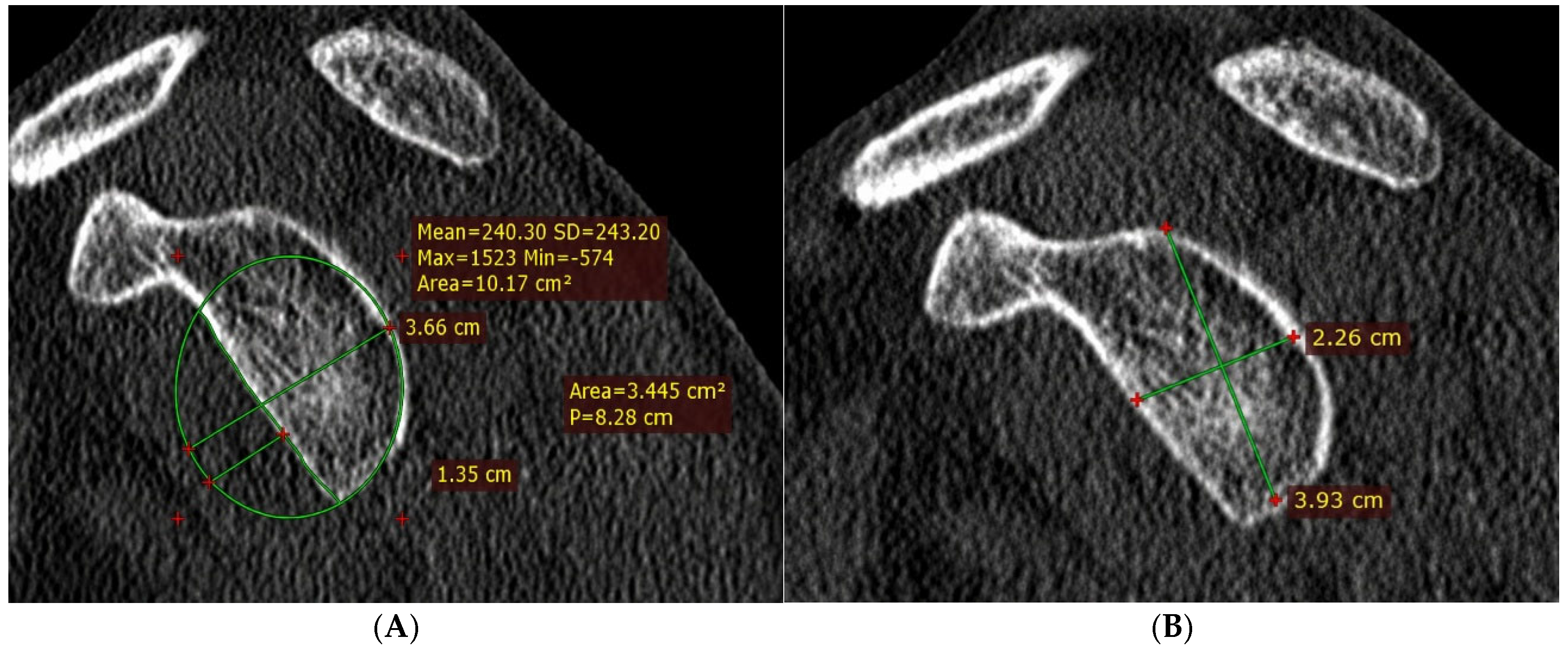 Jcm 15 08230 g003 Jcm 15 08230 g003