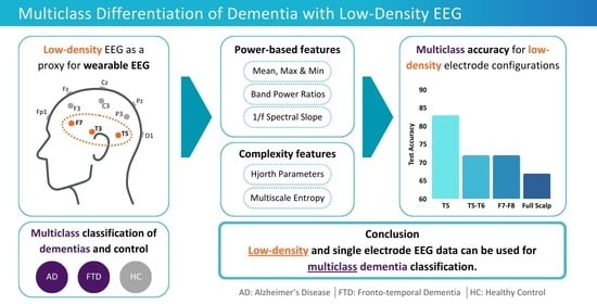 Workflow of the proposed approach, including EEG pre-processing, feature extraction, and machine learning classification.