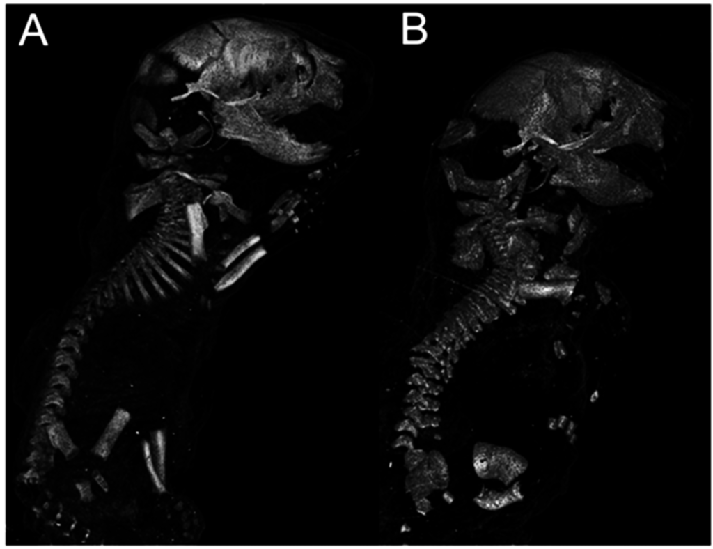 Jdb 03 00158 g001 1024