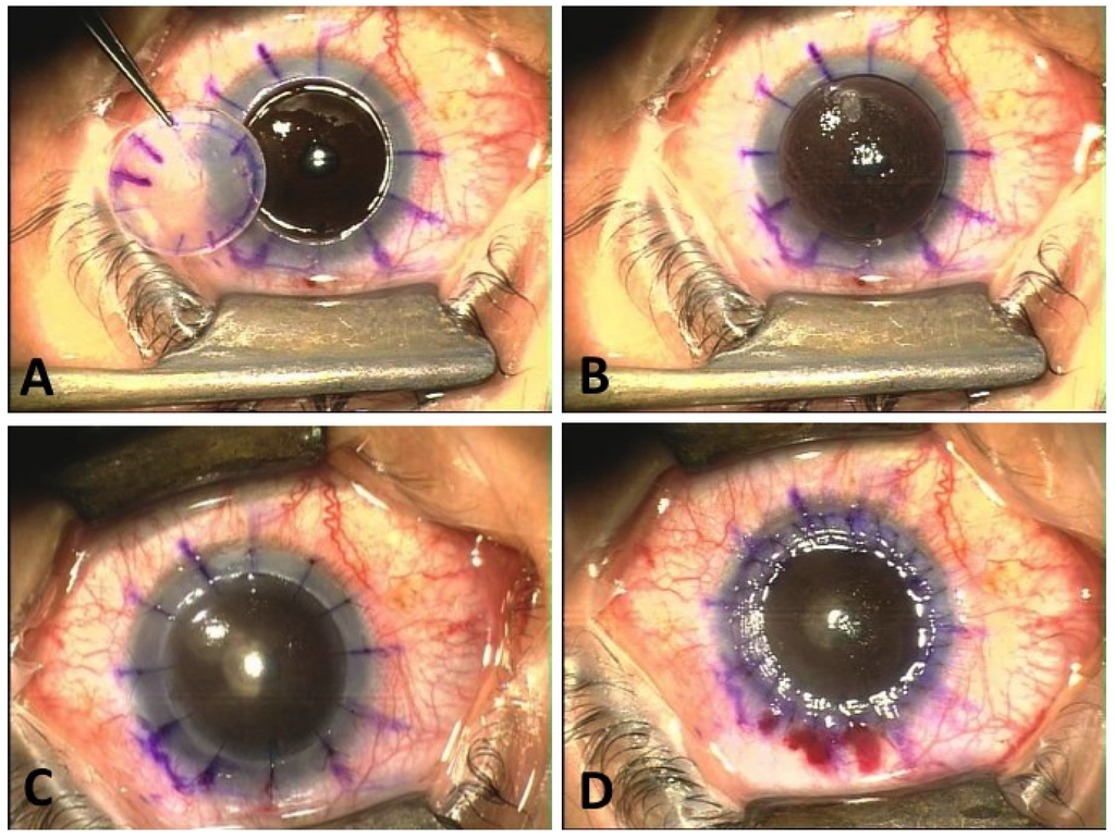 Jfb 05 00111 g001 1024