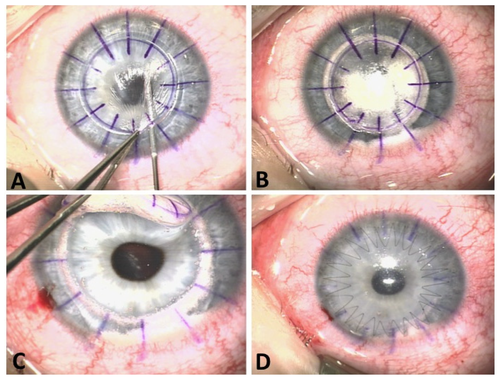 Jfb 05 00111 g002 1024