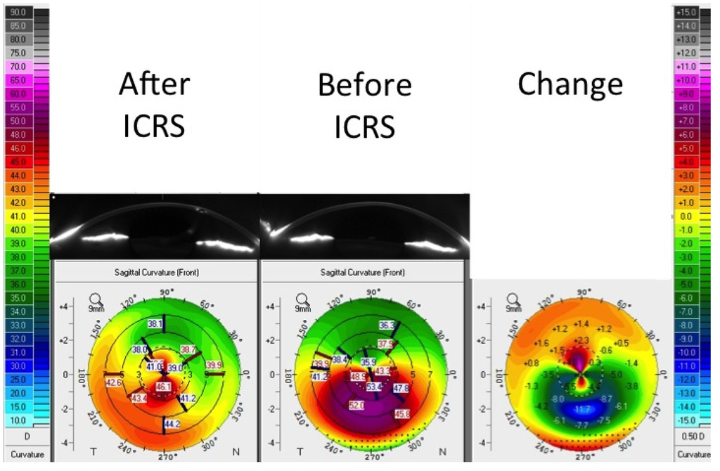 Jfb 05 00111 g003 1024