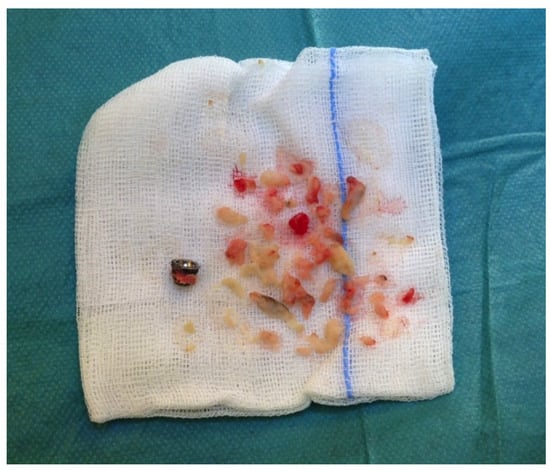 Jfb 06 00318 g002 550