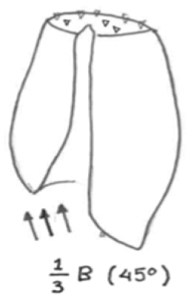 Jfb 11 00014 g003 Jfb 11 00014 g003