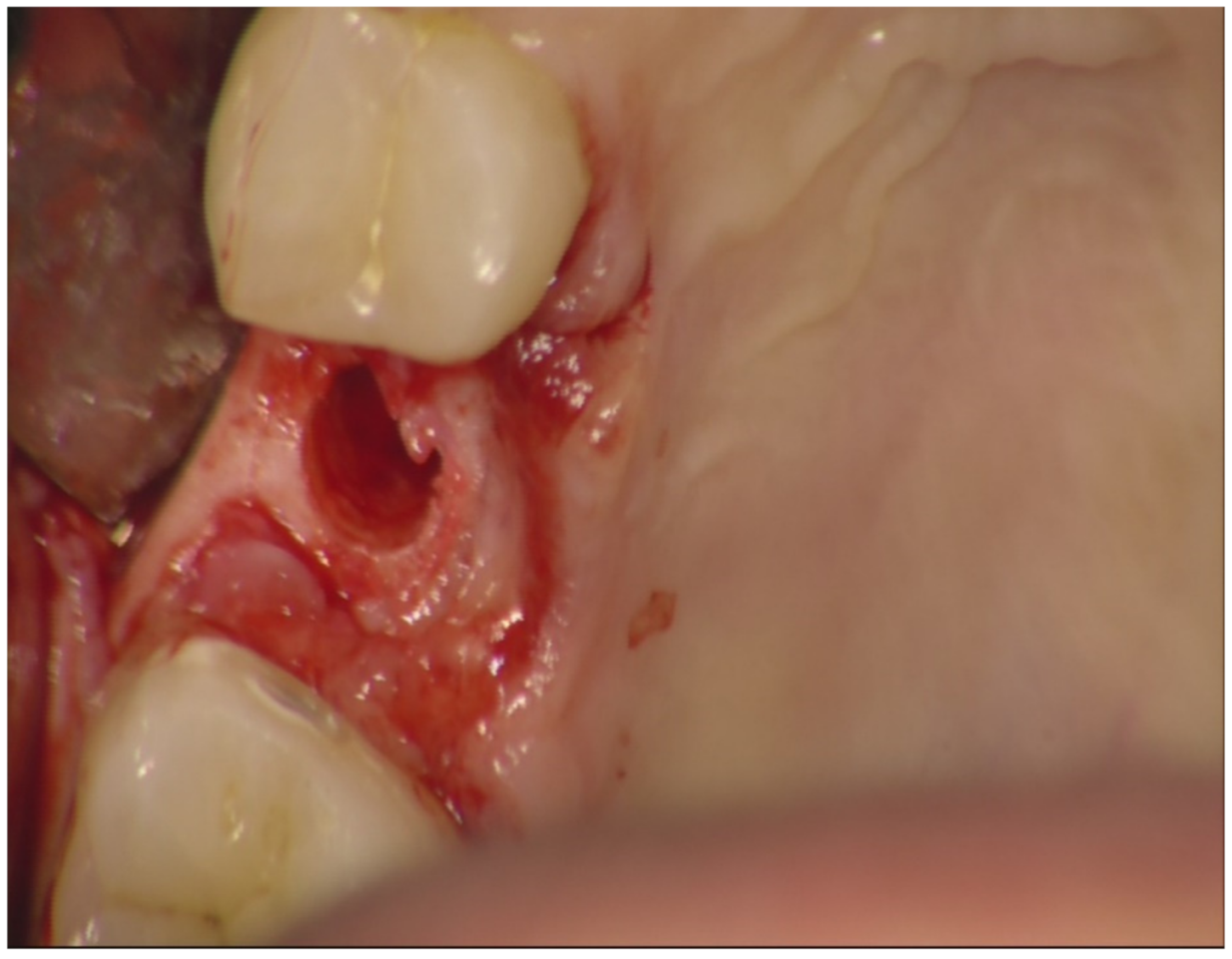 Jfb 12 00010 g002 Jfb 12 00010 g002