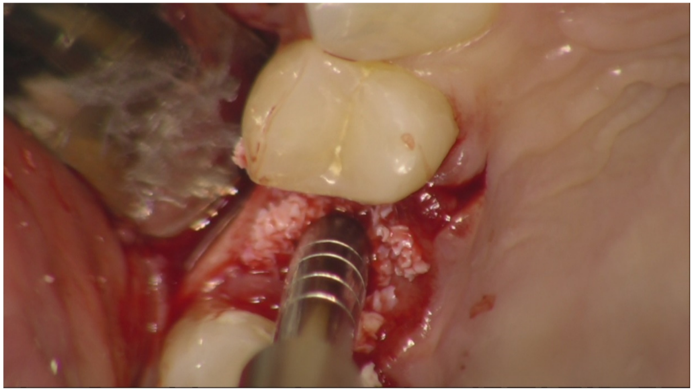 Jfb 12 00010 g003 Jfb 12 00010 g003