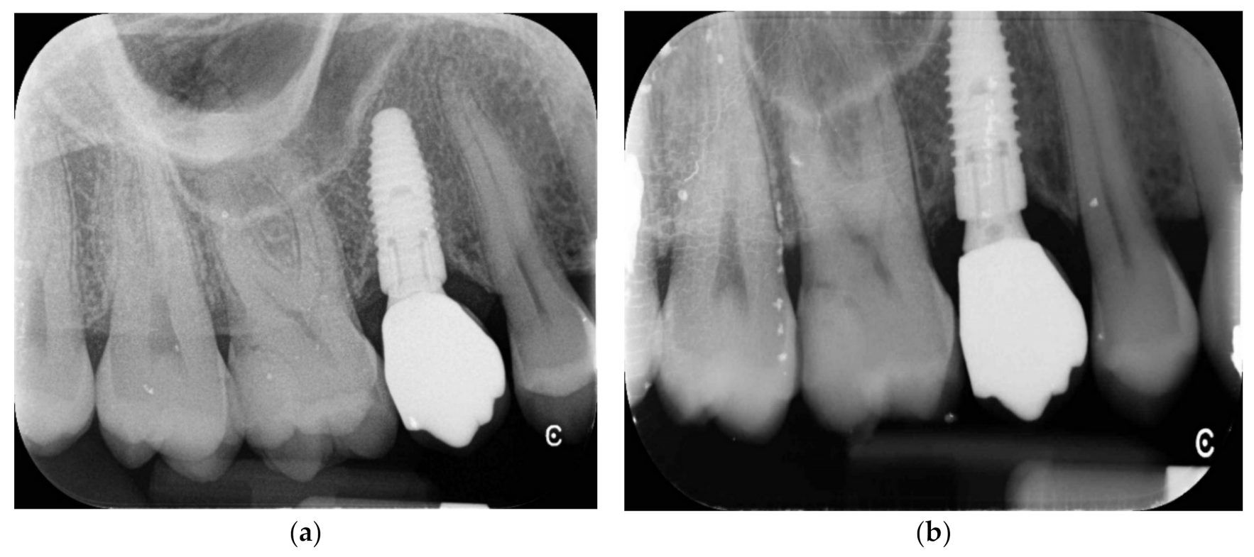 Jfb 12 00010 g006 Jfb 12 00010 g006