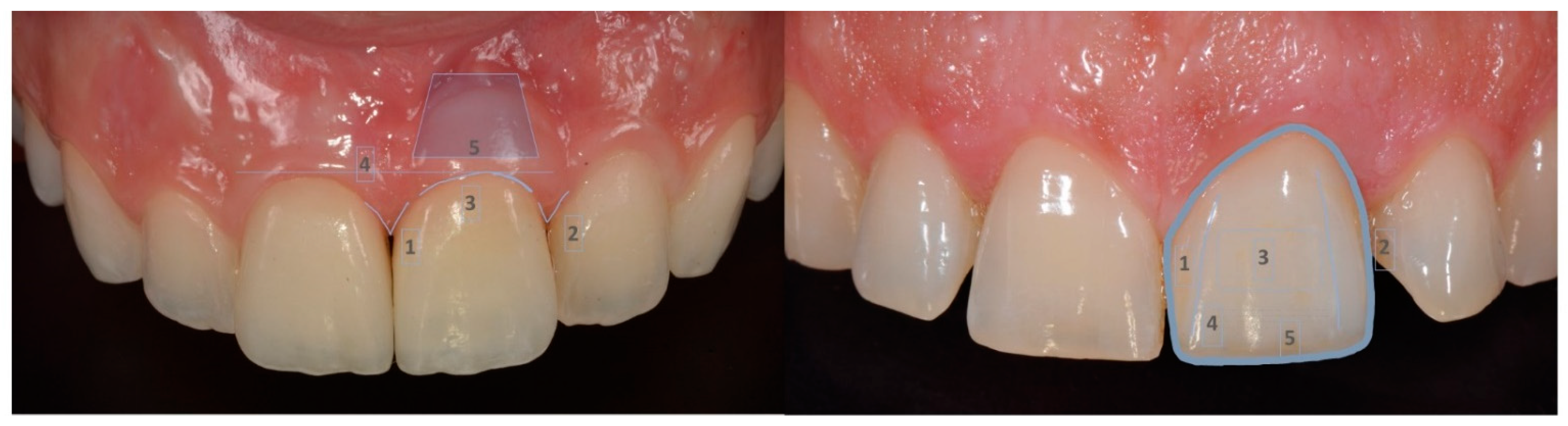 Jfb 12 00035 g002 Jfb 12 00035 g002