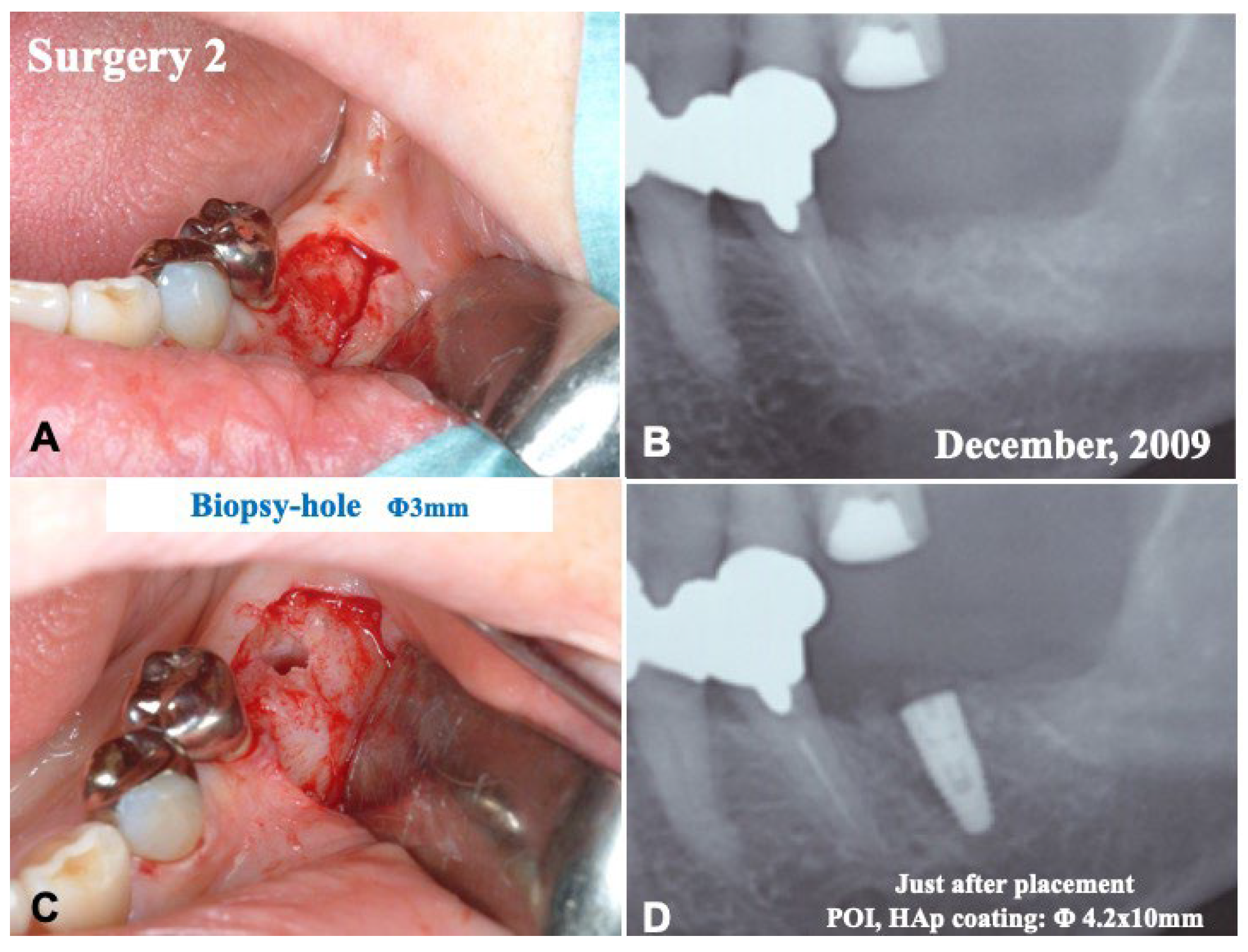 Jfb 13 00066 g004 Jfb 13 00066 g004