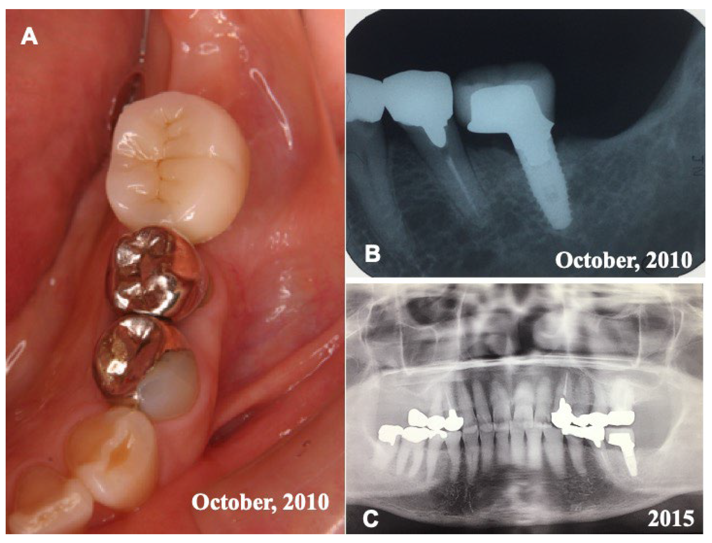 Jfb 13 00066 g005 Jfb 13 00066 g005