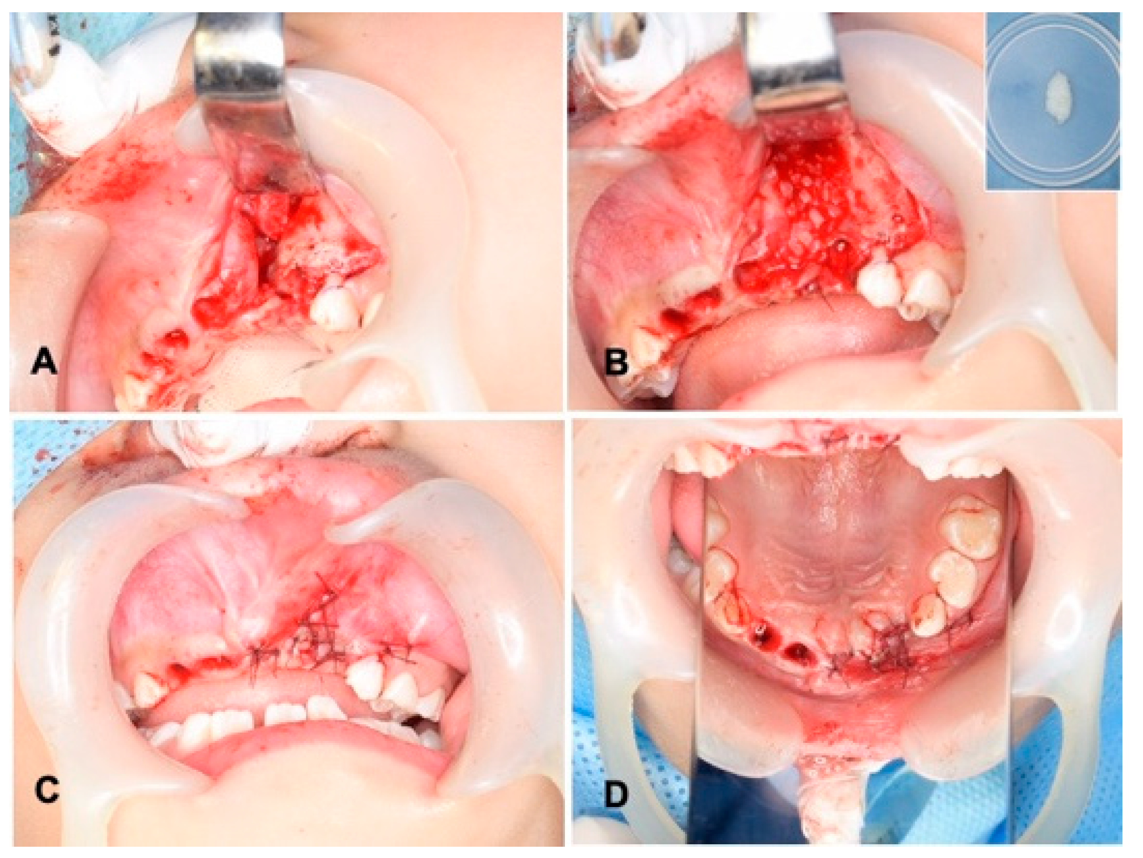 Jfb 13 00153 g003 Jfb 13 00153 g003