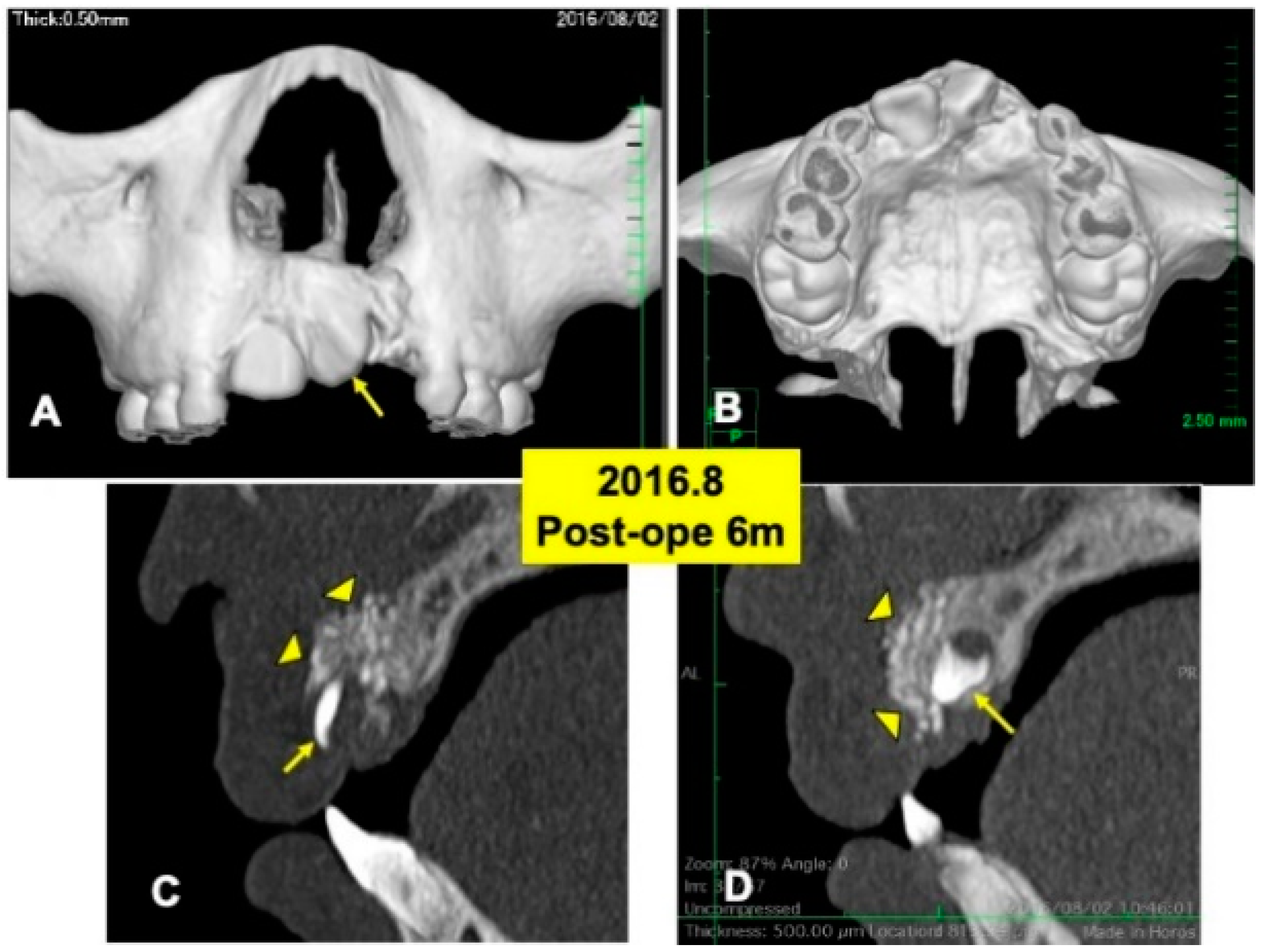 Jfb 13 00153 g004 Jfb 13 00153 g004