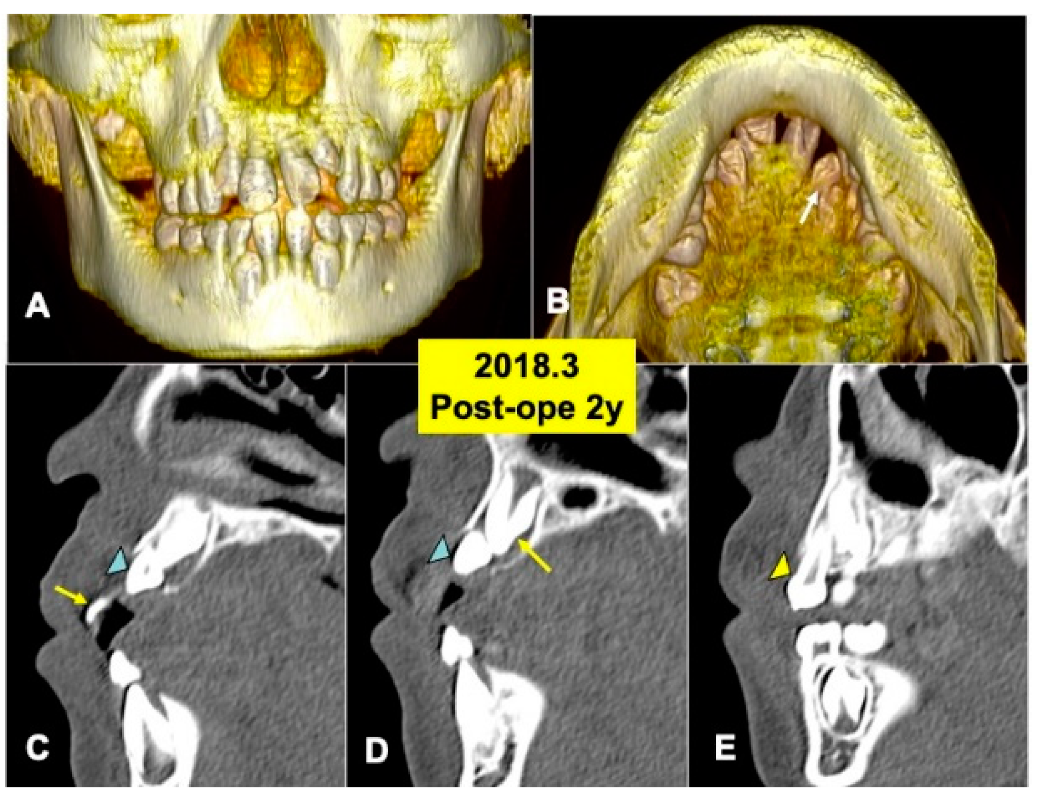 Jfb 13 00153 g005 Jfb 13 00153 g005