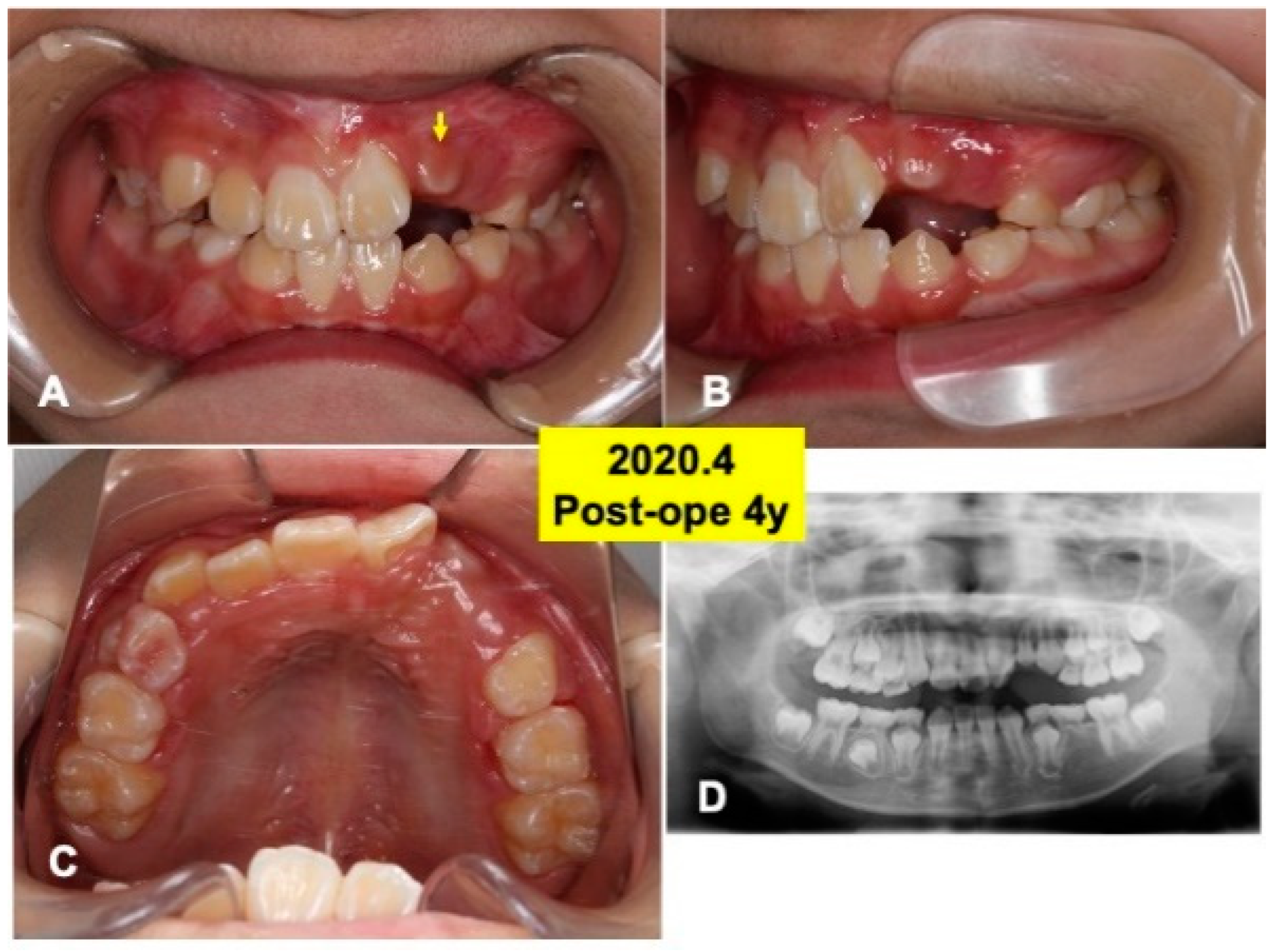 Jfb 13 00153 g006 Jfb 13 00153 g006