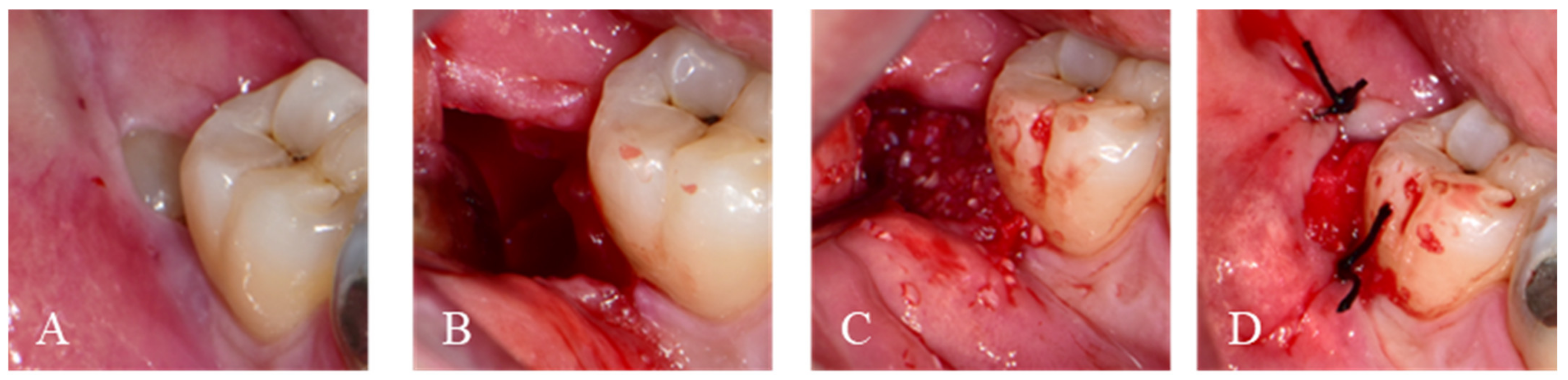 Jfb 14 00004 g001 Jfb 14 00004 g001