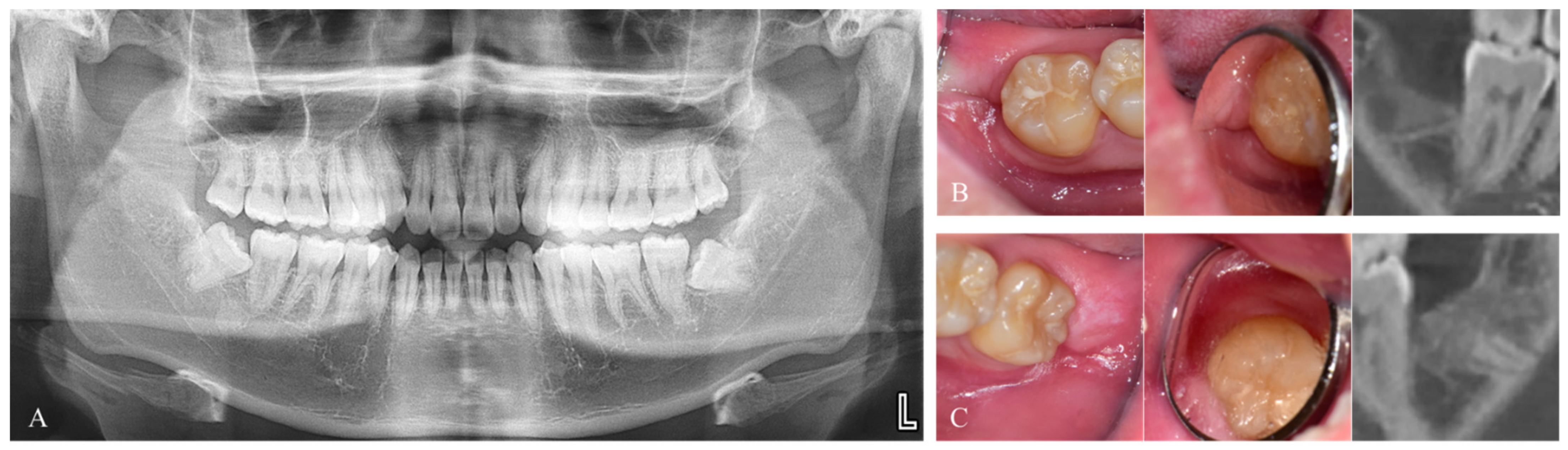 Jfb 14 00004 g004 Jfb 14 00004 g004