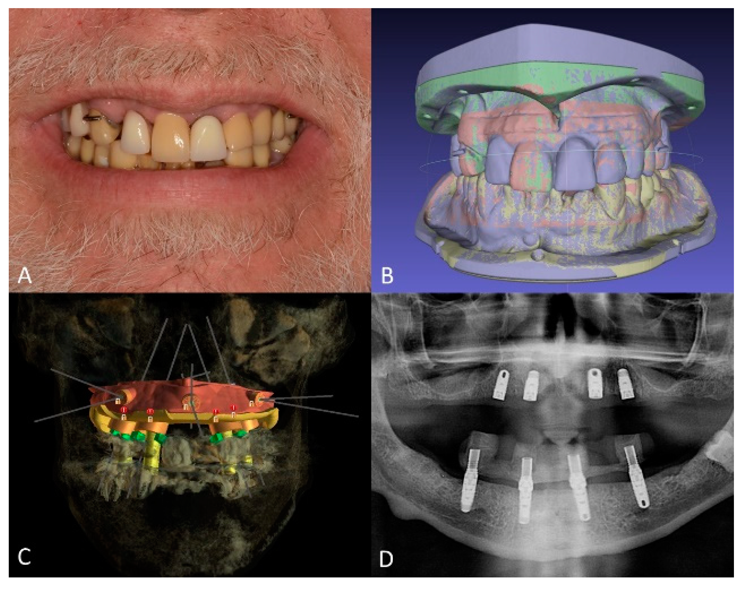 Jfb 14 00174 g004 Jfb 14 00174 g004
